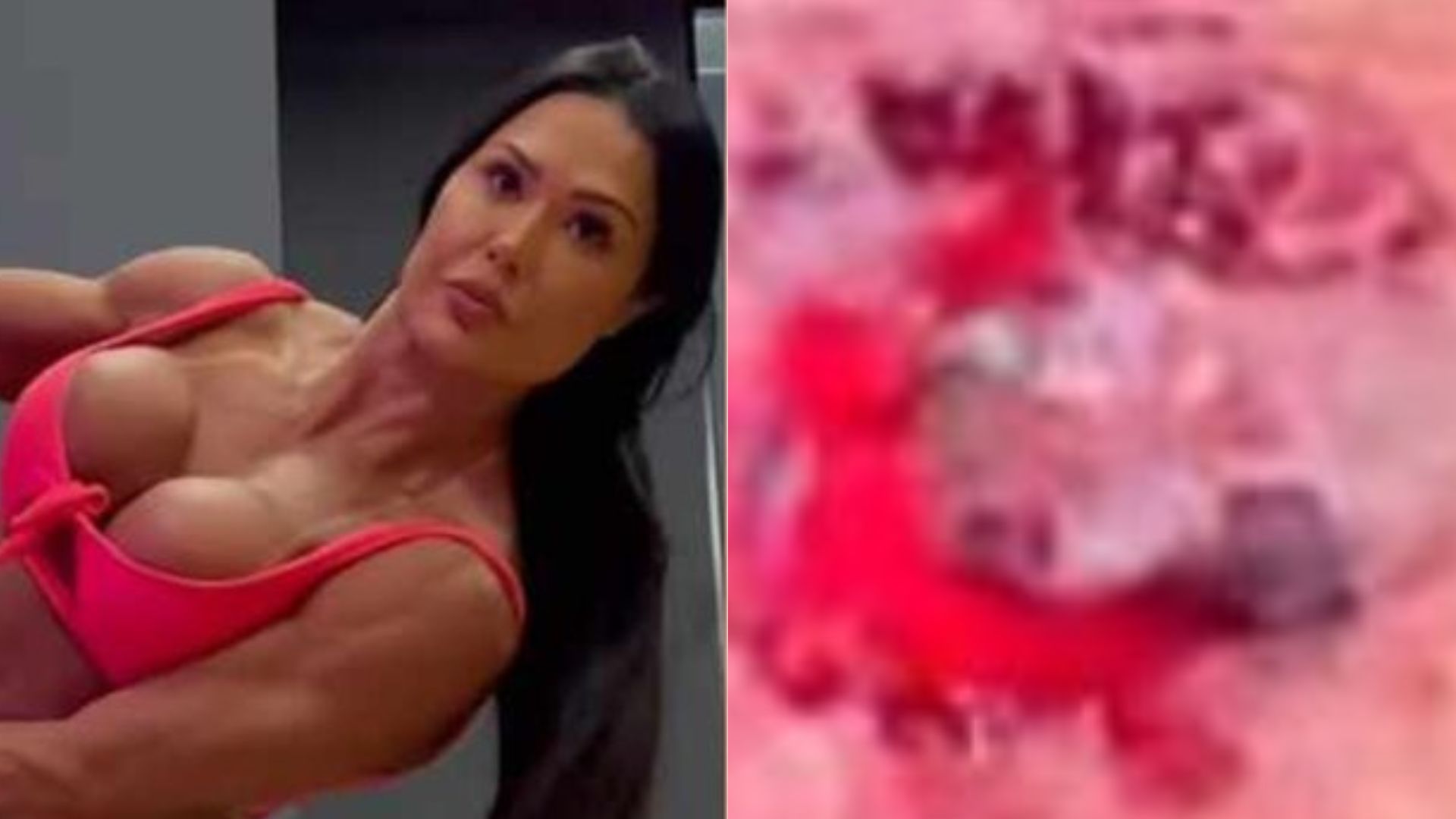 Gracyanne Barbosa sofre acidente e assusta web com machucado: “Pele arrancou”