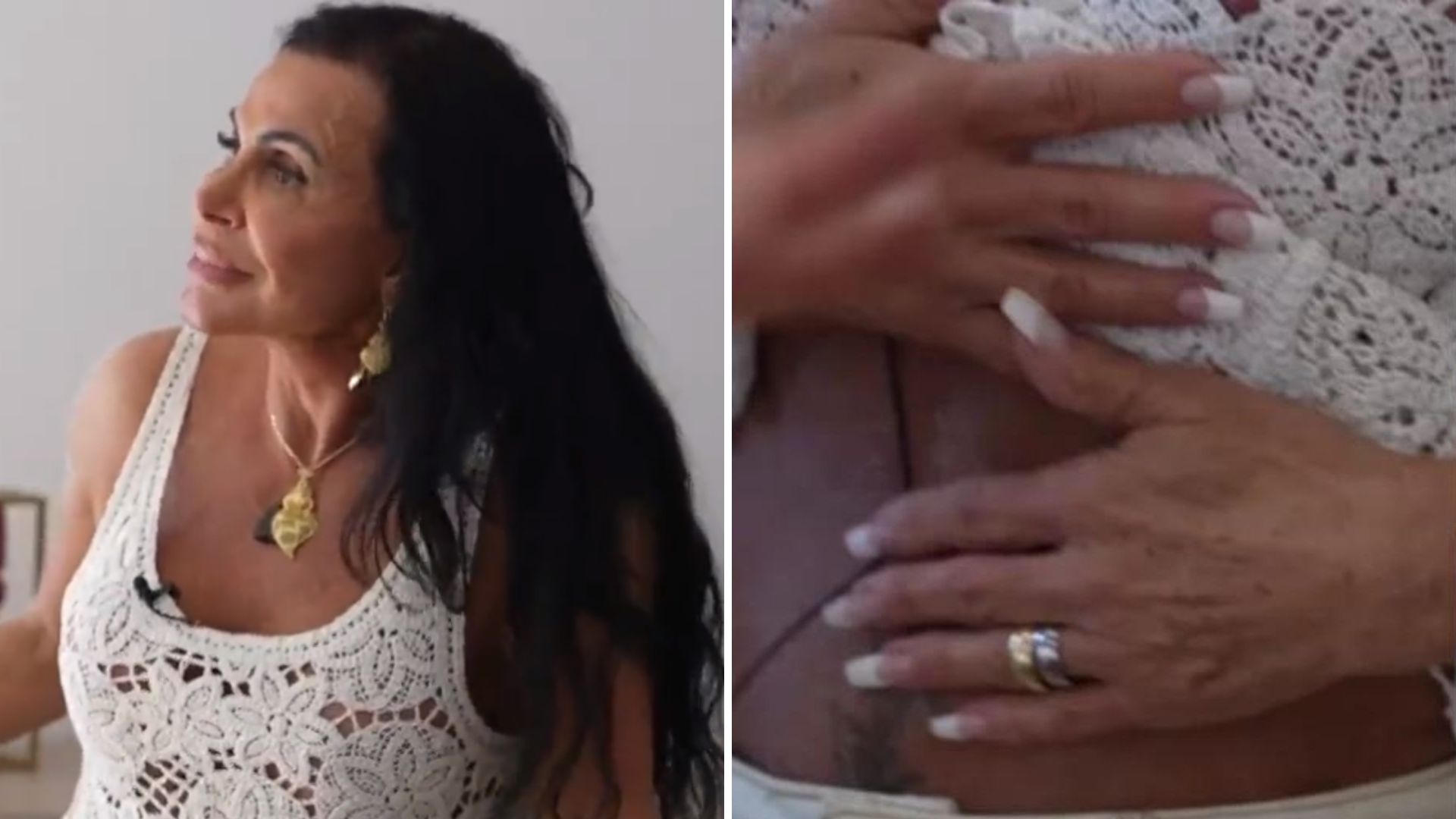 Umbigo deformado? Gretchen levanta a blusa e mostra barriga após cirurgias: “Estourou”