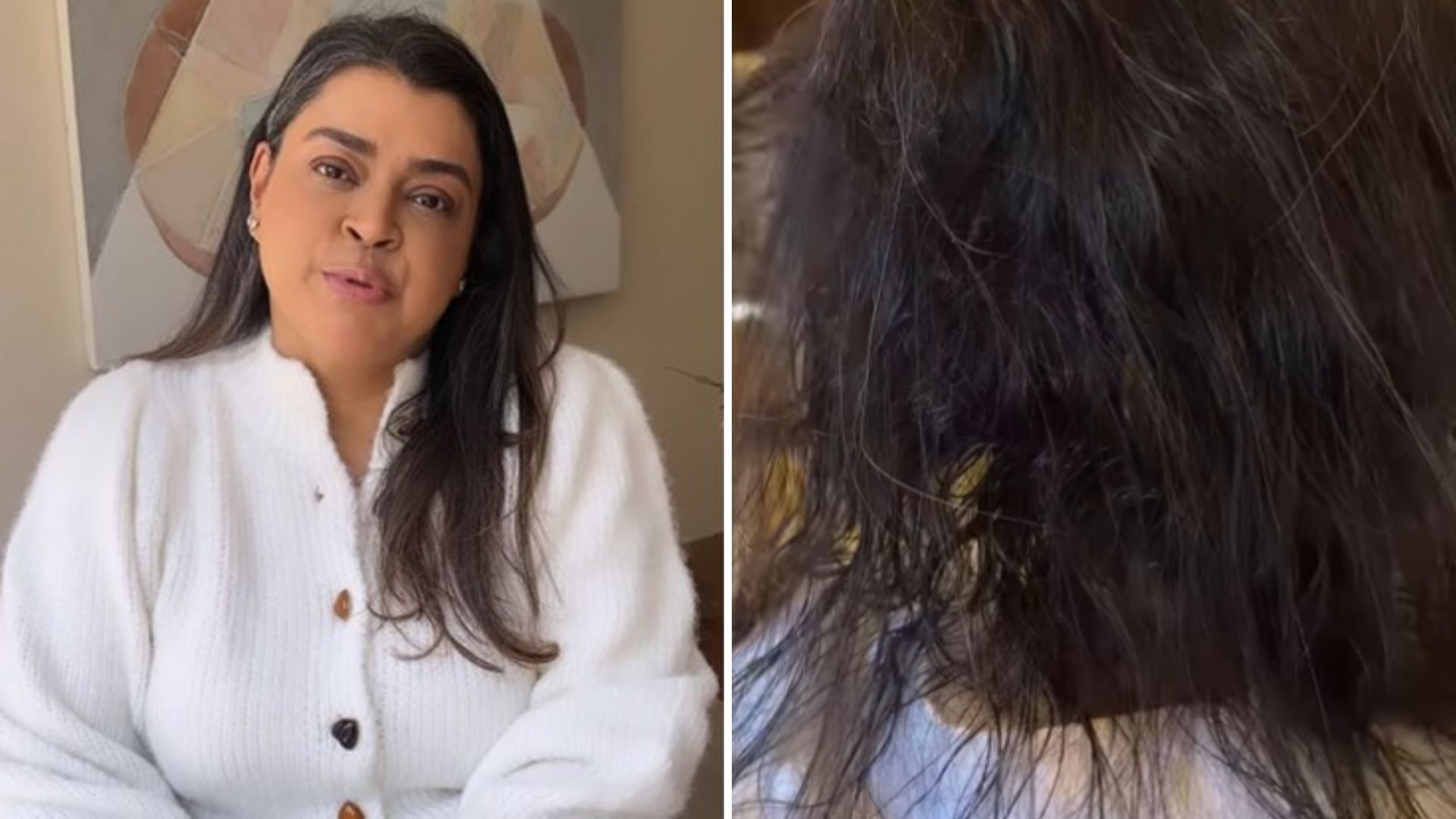 Preta Gil tira o aplique e mostra cabelo após a quimioterapia: “Caiu muito”