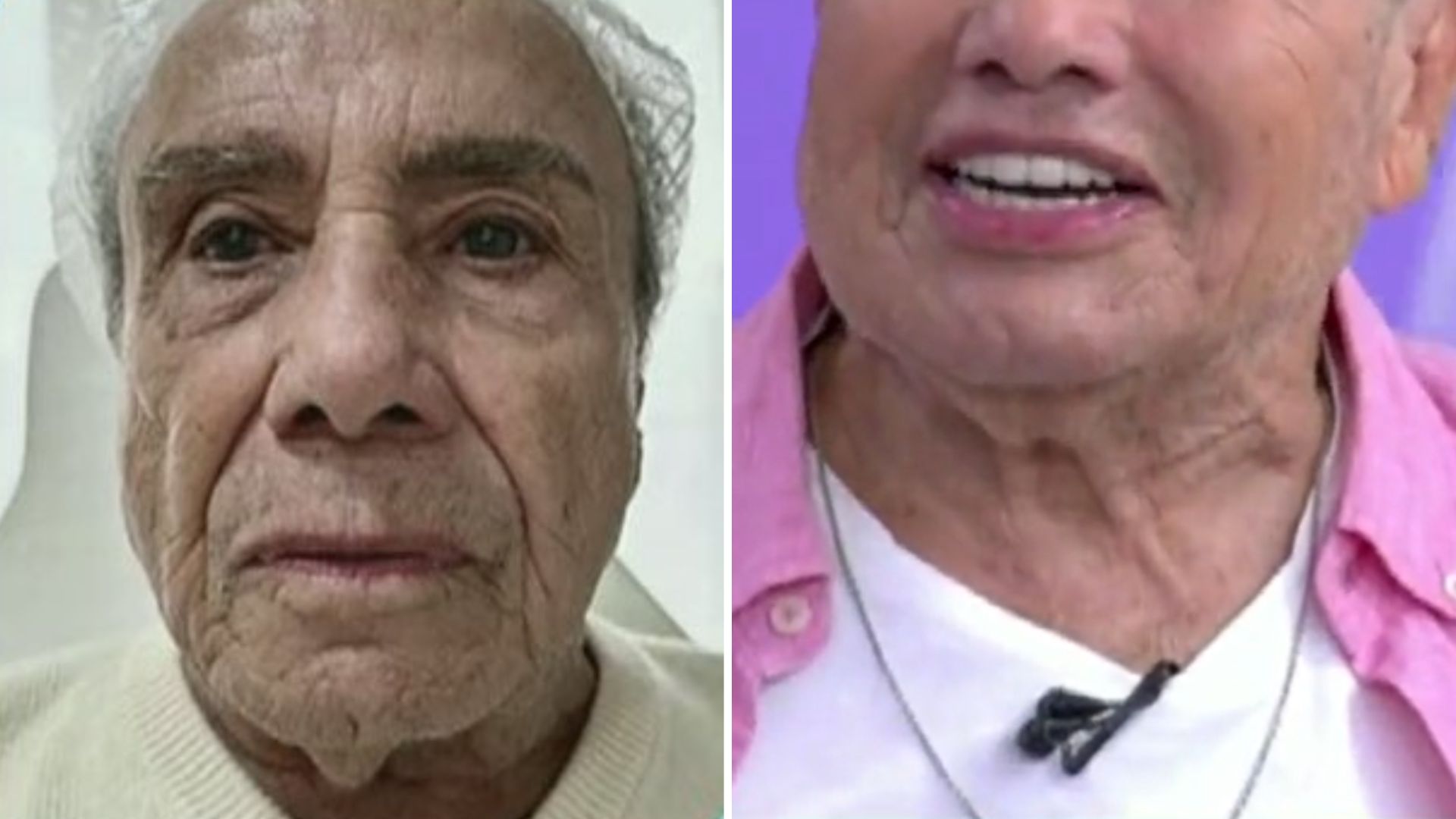 Stênio Garcia passa por harmonização drástica e telespectadores se assustam: “Outra pessoa”