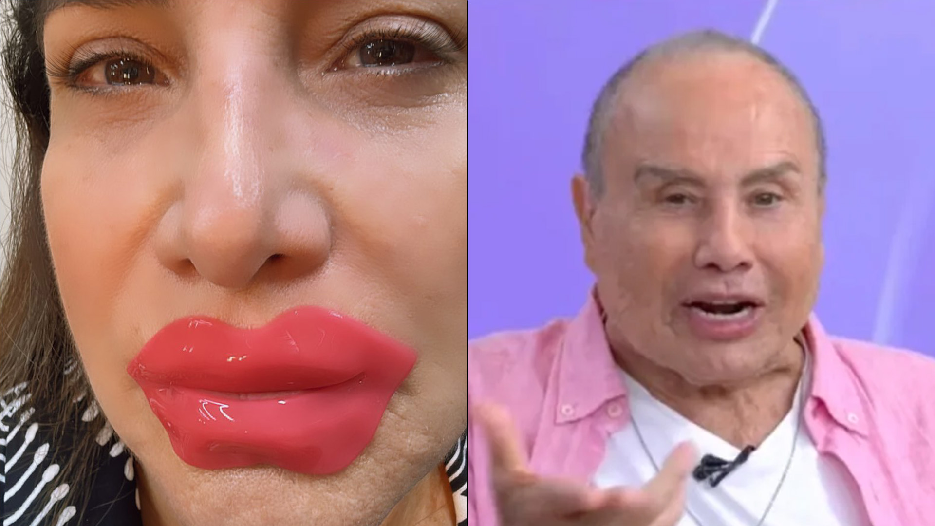 Indireta? Totia Meireles debocha de harmonização facial após Stênio Garcia fazer procedimento: “Venenosa”