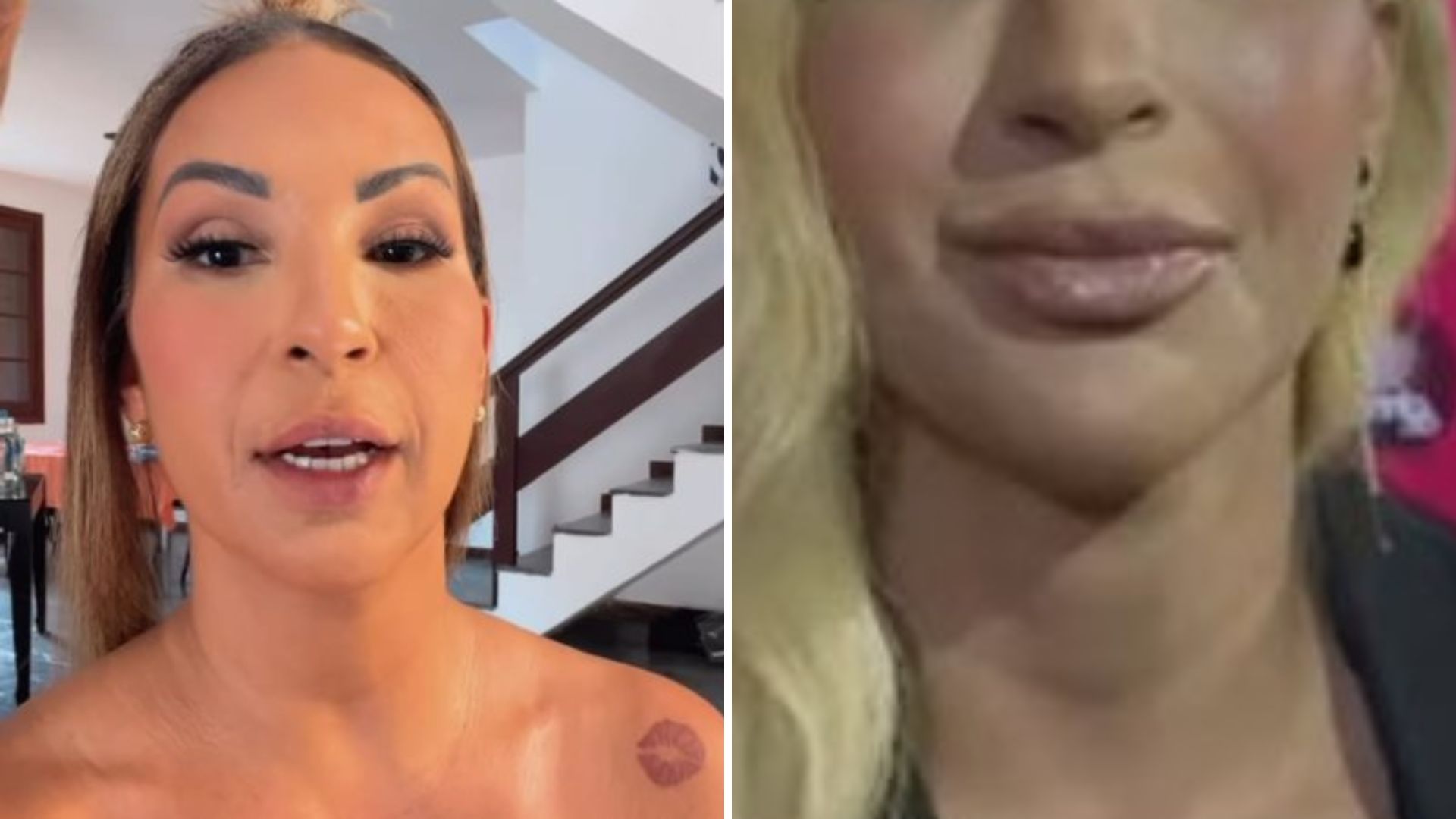 Valesca Popozuda surge completamente diferente em nova harmonização facial: “O que aconteceu?”