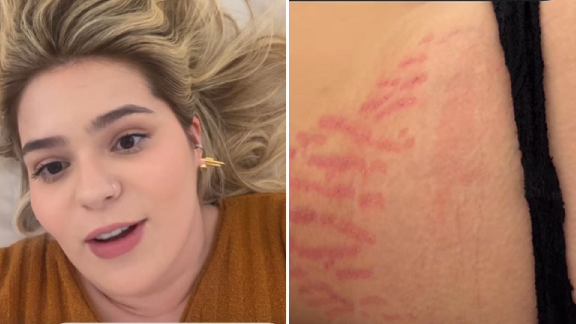 Viih Tube mostra eliminação de estrias na barriga dois meses pós-parto: “Tô chocada”