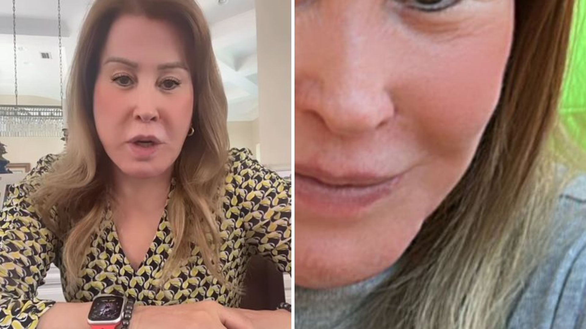 Zilu Camargo surge com rosto ‘repaginado’ e fãs não perdoam: “Não se aceita”