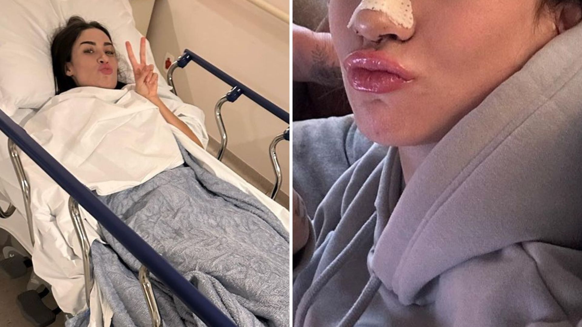 Bianca Andrade se clica bem diferente após refazer rinoplastia: “A cirurgia demandou muito”