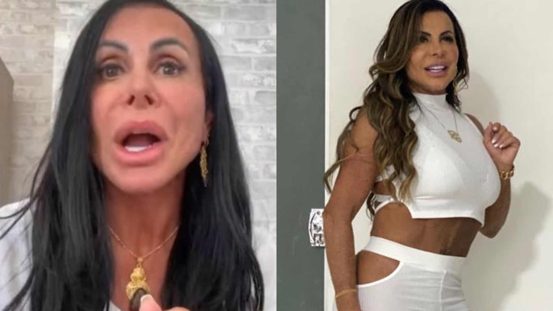 Após ser diagnosticada com alopécia, Gretchen usa nova técnica em tratamento; entenda