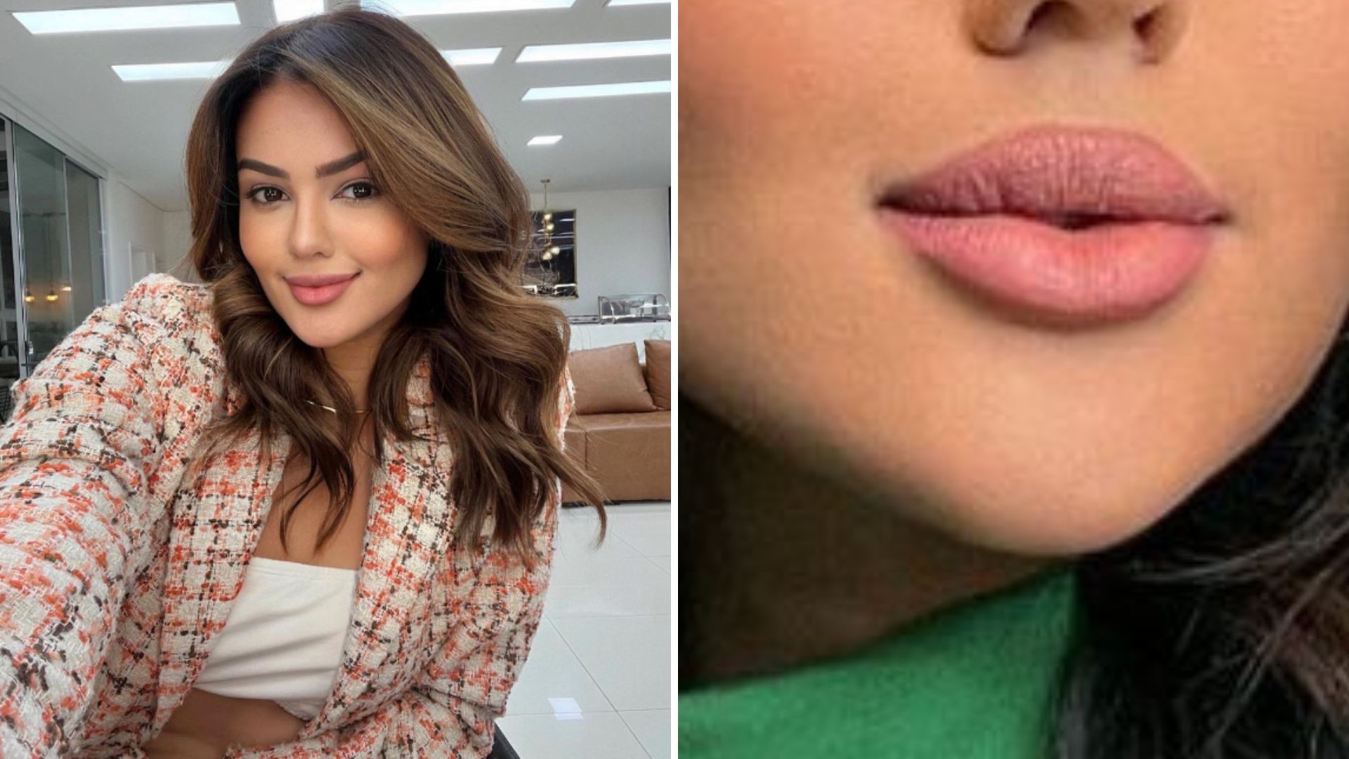 Ex-BBB Eslovênia causa estranhamento ao surgir com rosto totalmente diferente: “Não precisava”