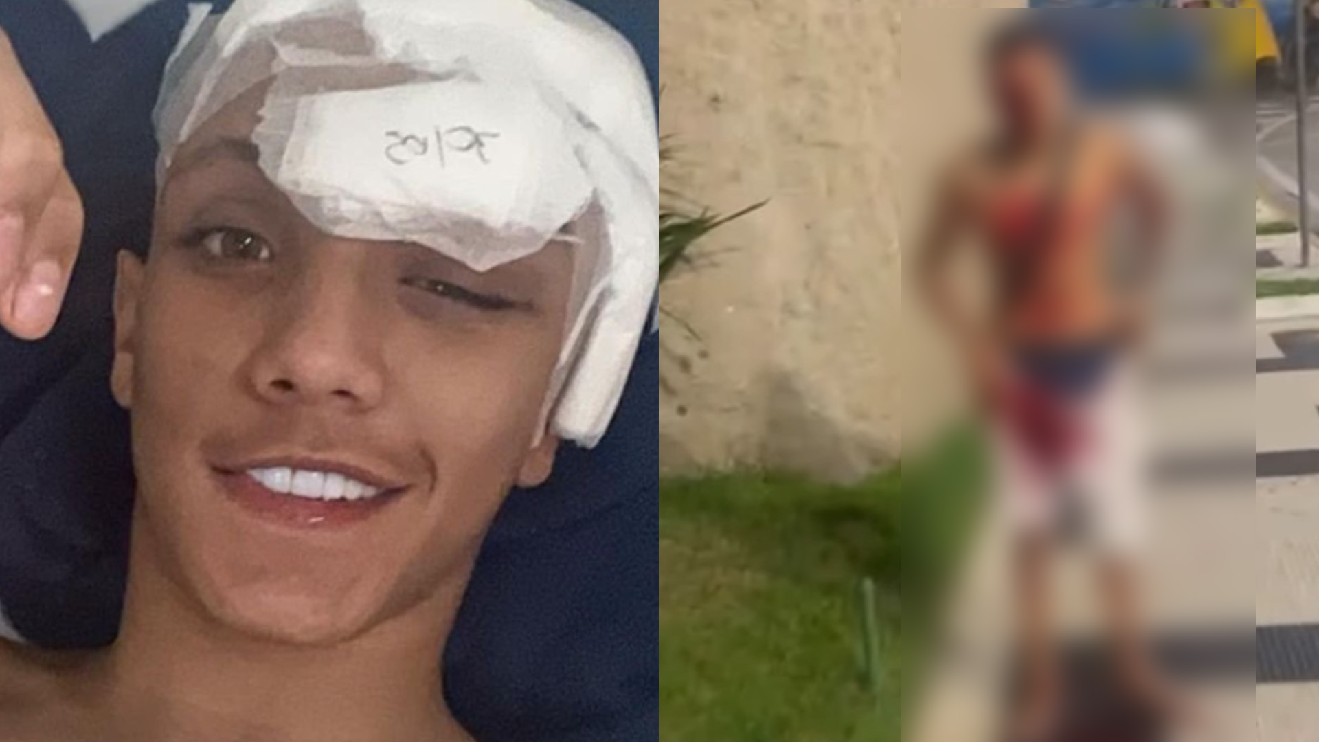 Influenciador baleado na cabeça sobrevive e surge sorrindo no hospital: “Renasceu”