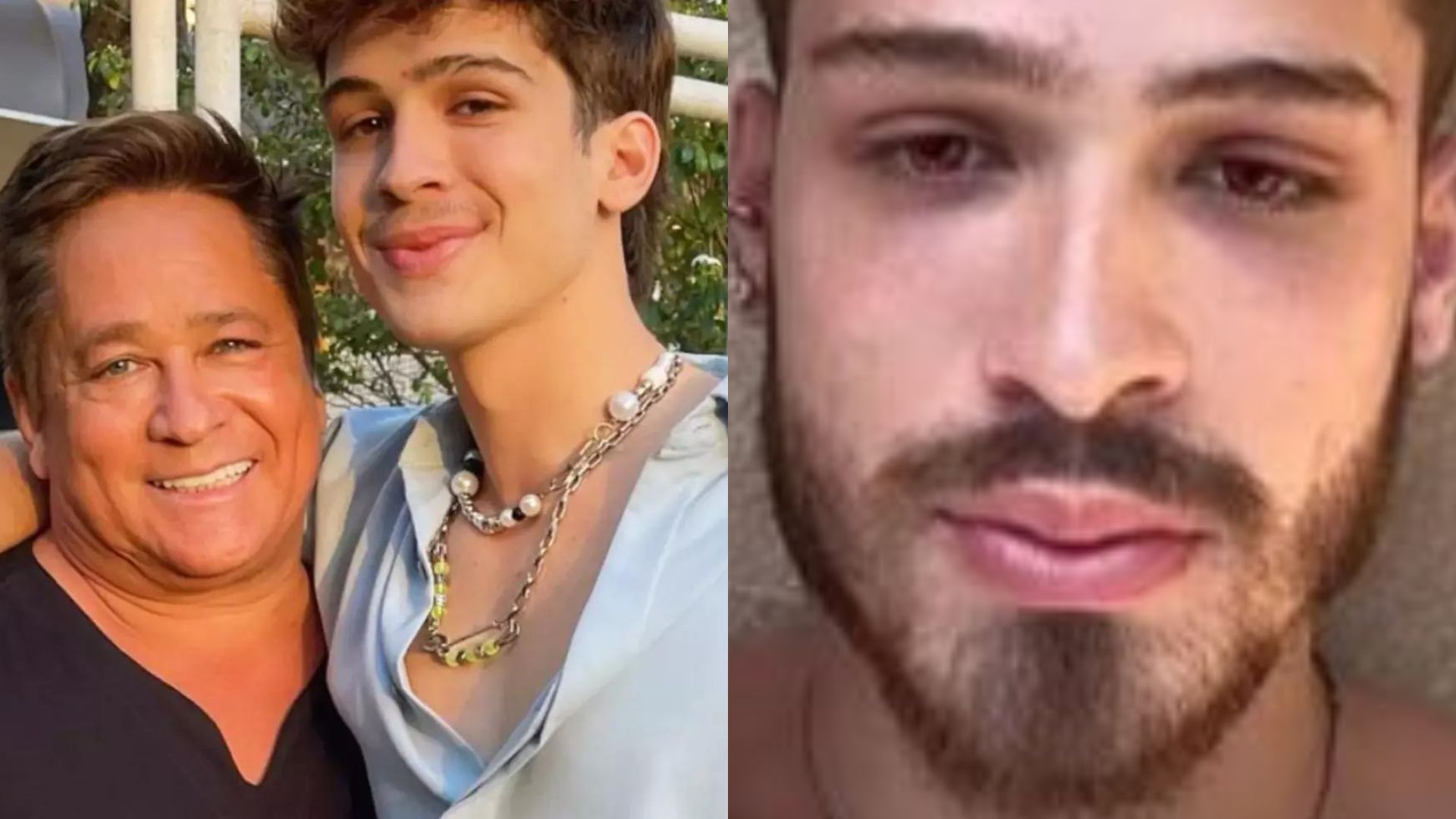 Filho de Leonardo, João Guilherme assusta fãs ao surgir ferido: “Meu rosto”