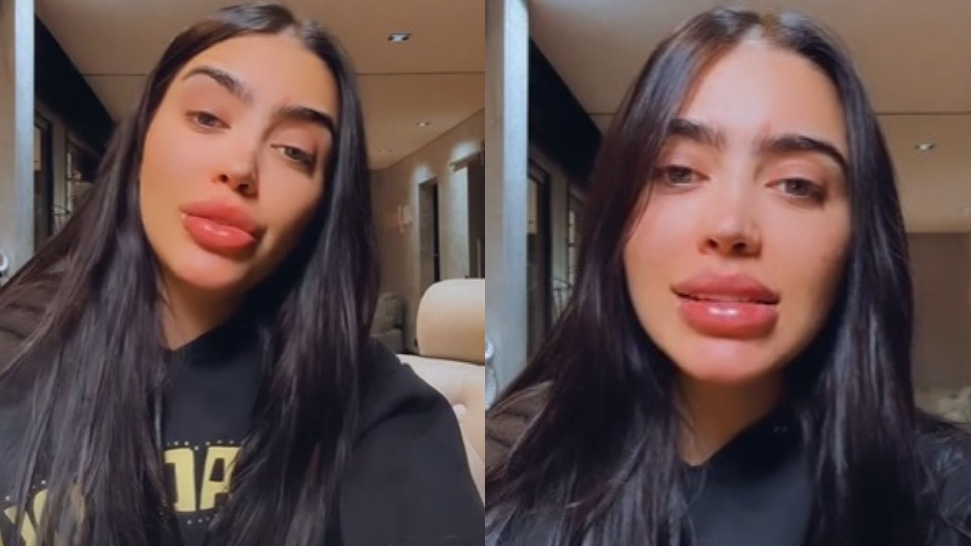Grávida, MC Mirella sofre acidente e é levada às pressas para hospital: “Doeu”