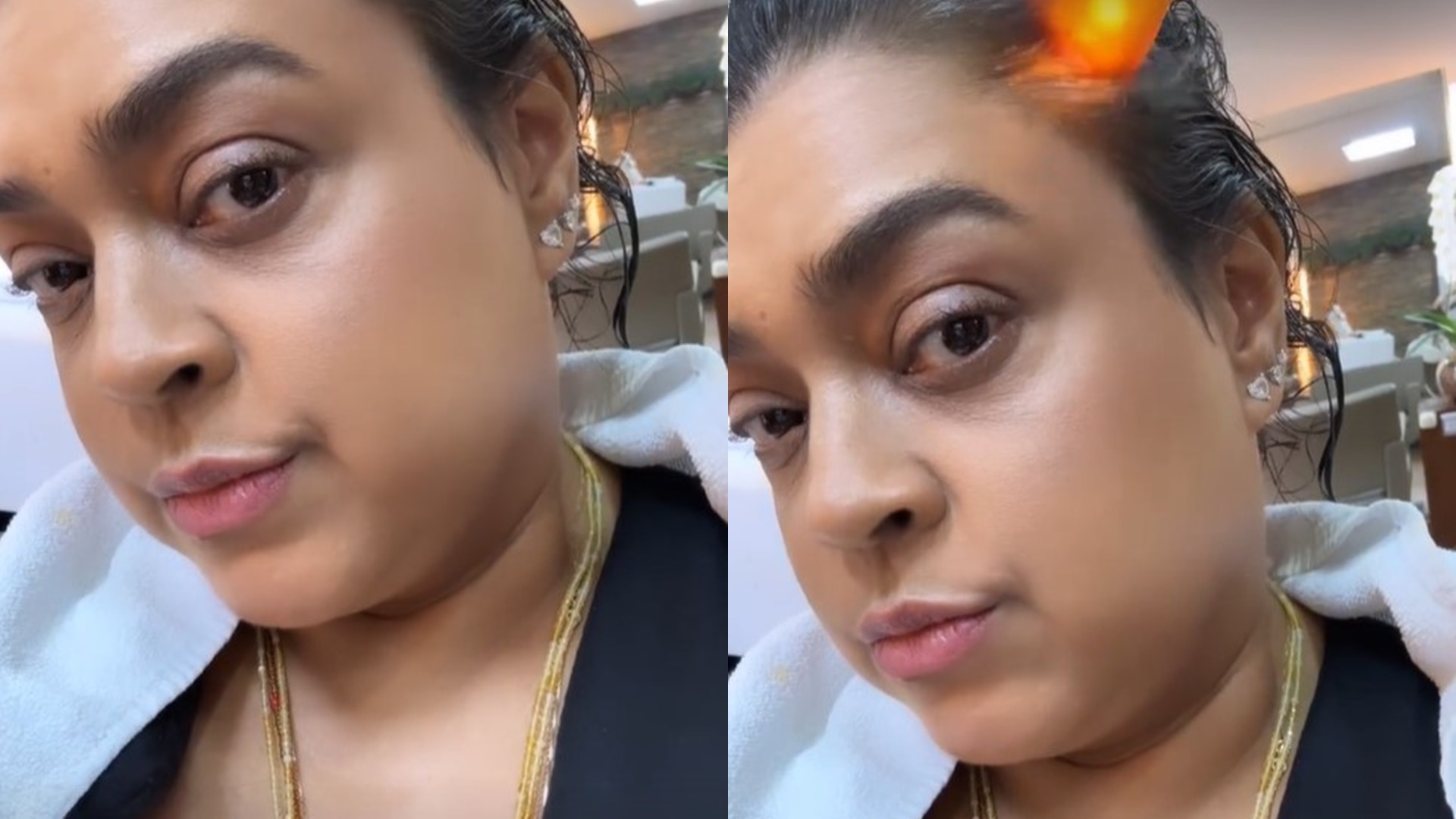 Preta Gil desabafa sobre queda de cabelo em tratamento contra câncer: “Caiu muito”