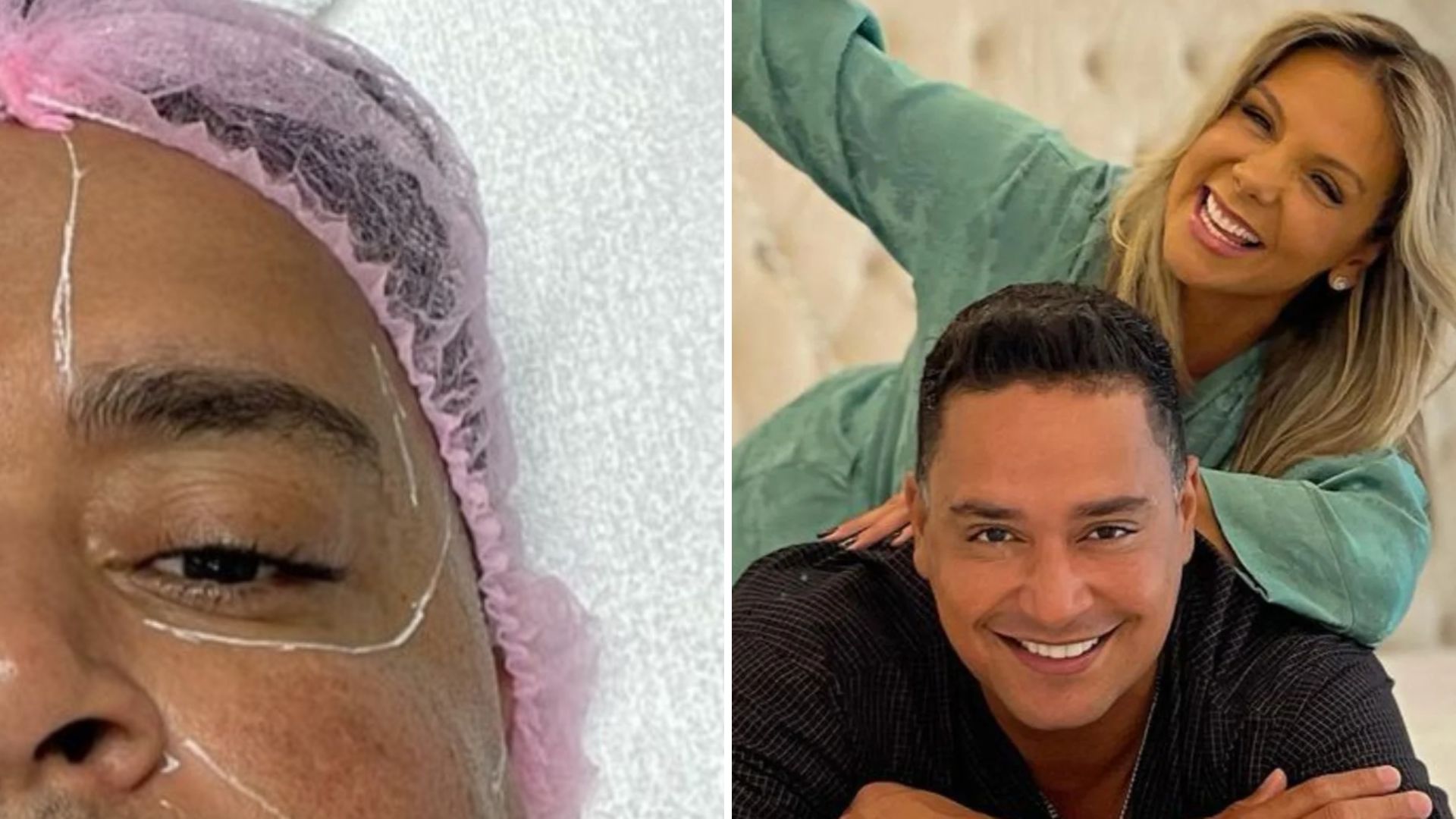 Xanddy faz procedimento no rosto a pedido de Carla Perez: “Topei”