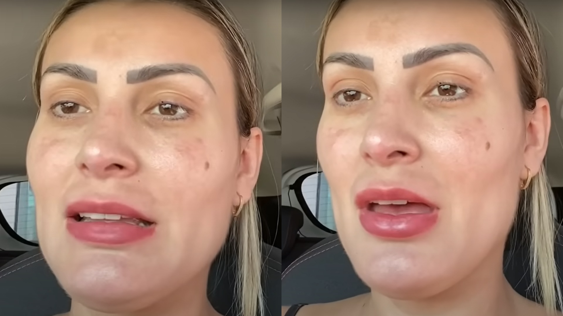 Andressa Urach nega segunda chance após perdoar o ex-marido: “Decidimos ser amigos”