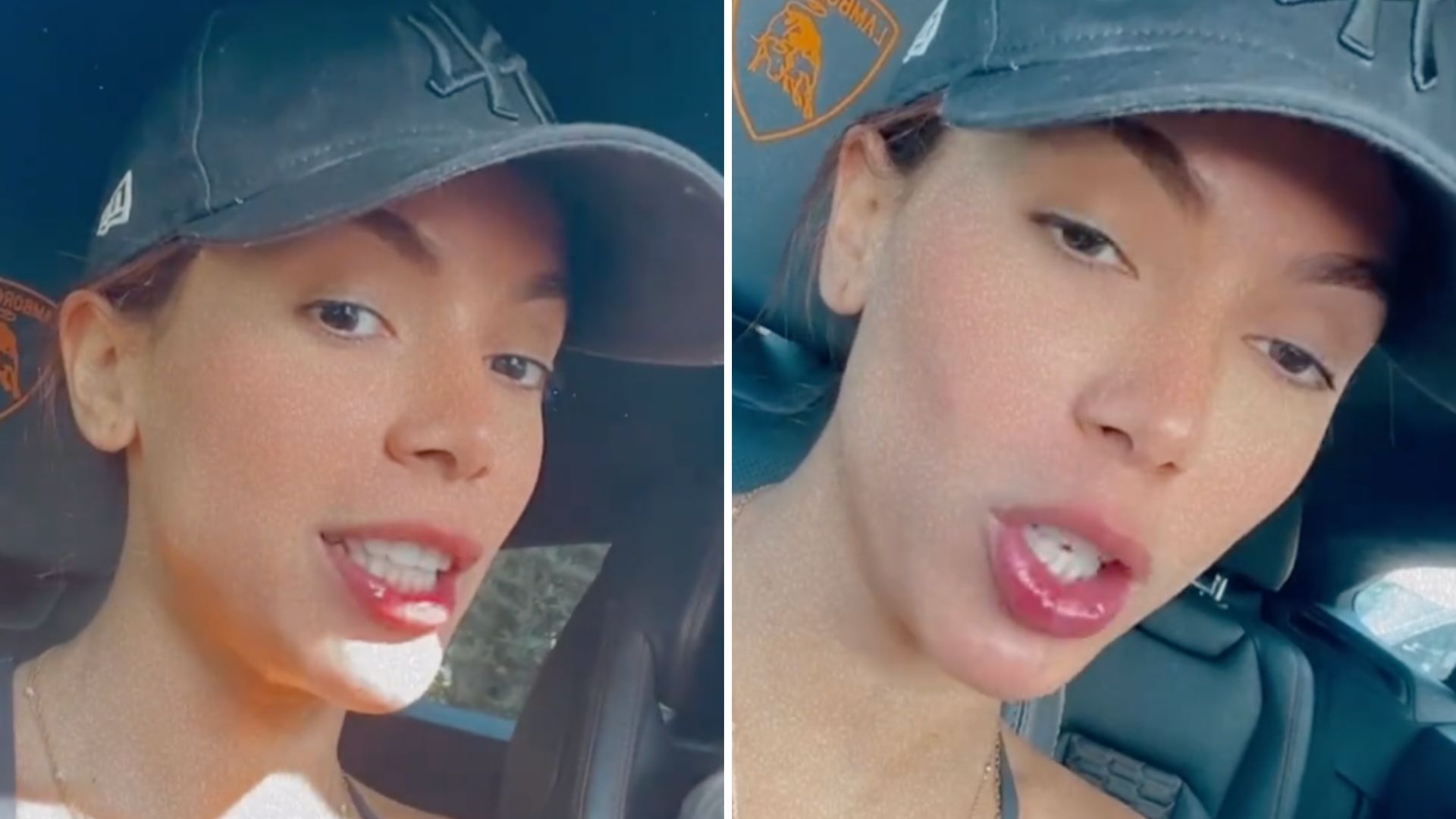 Anitta detona amigos que reclamaram de regras em sua festa: “Só não ir”