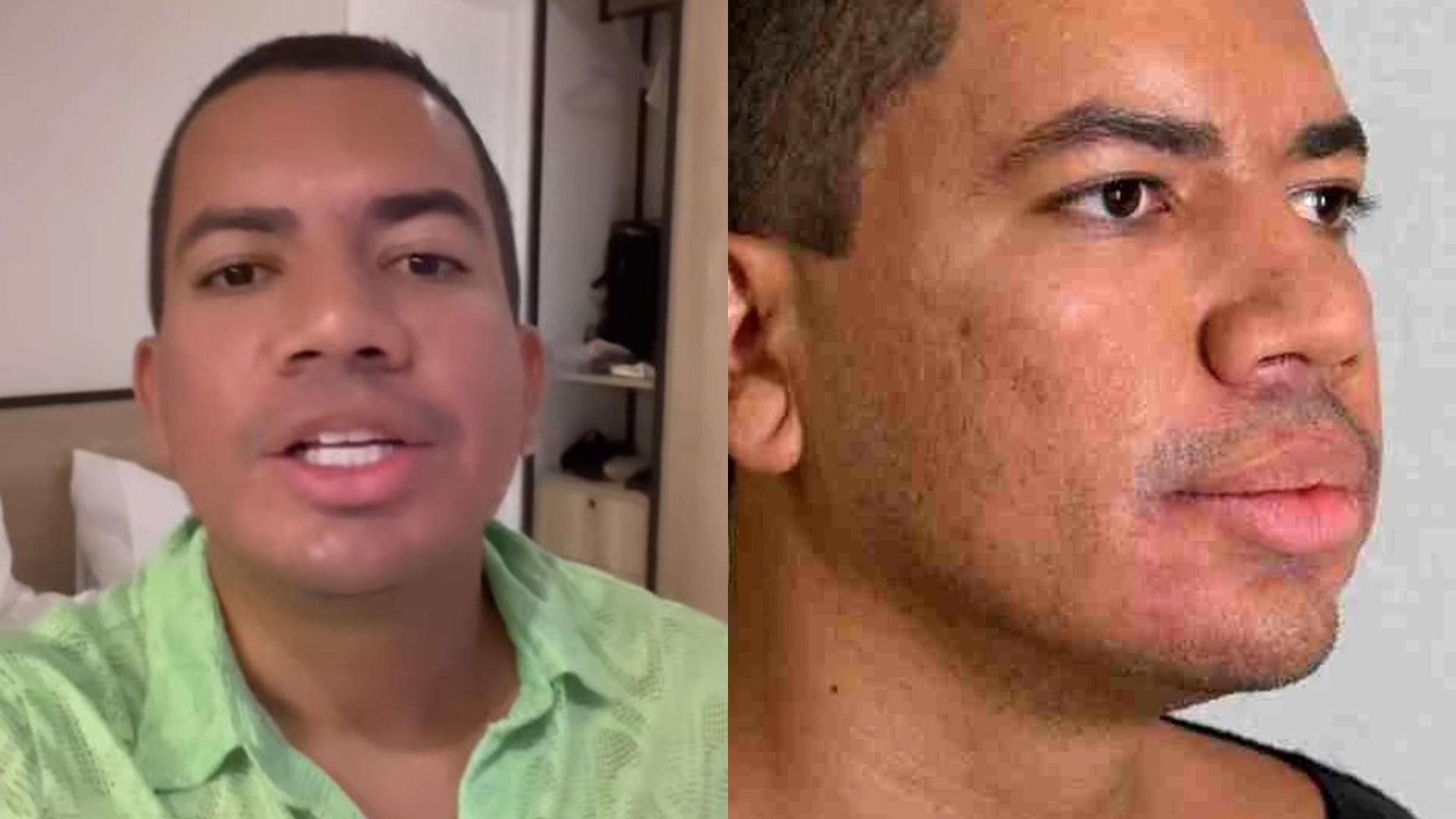 BBB23: Bruno Gaga rebate críticas após fazer harmonização facial: “Realçando minha beleza”