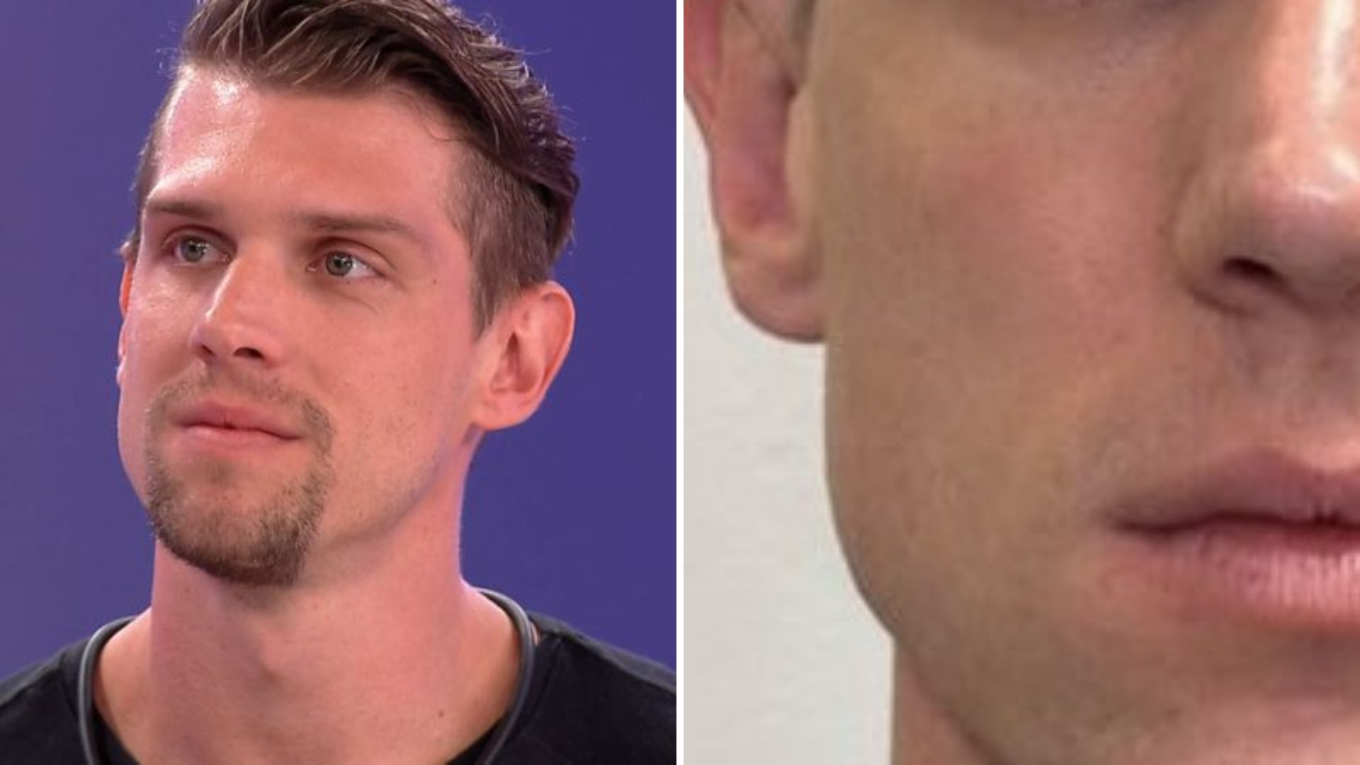 Ex-BBB Cristian desembolsa valor expressivo com harmonização e web reage: “Nada mudou”