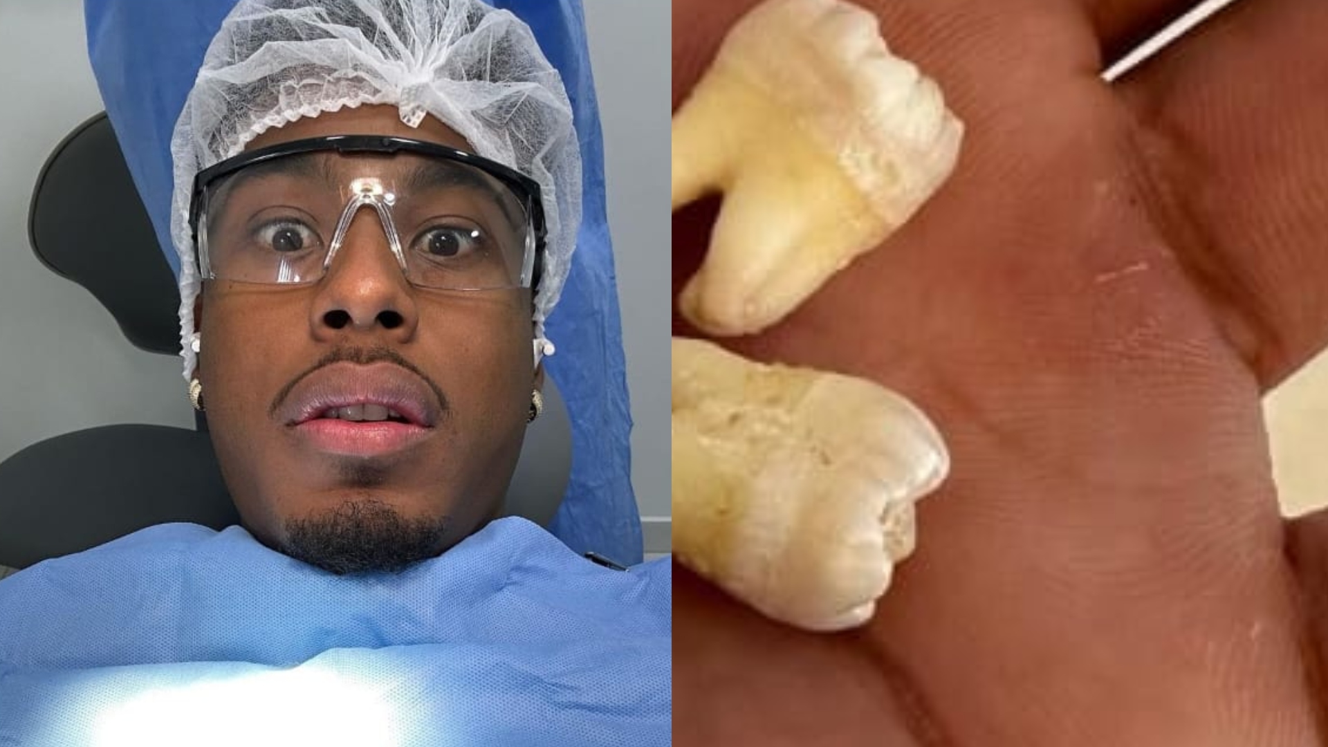 Avantajados! Paulo André extrai os 4 sisos e tamanho do dente choca: “Como pode?”