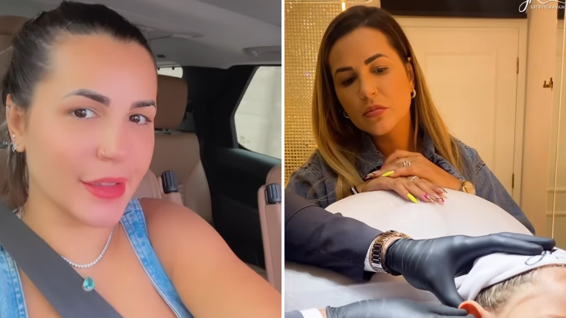Deolane explica motivo para filha realizar procedimento após criticas: “Tive certeza”