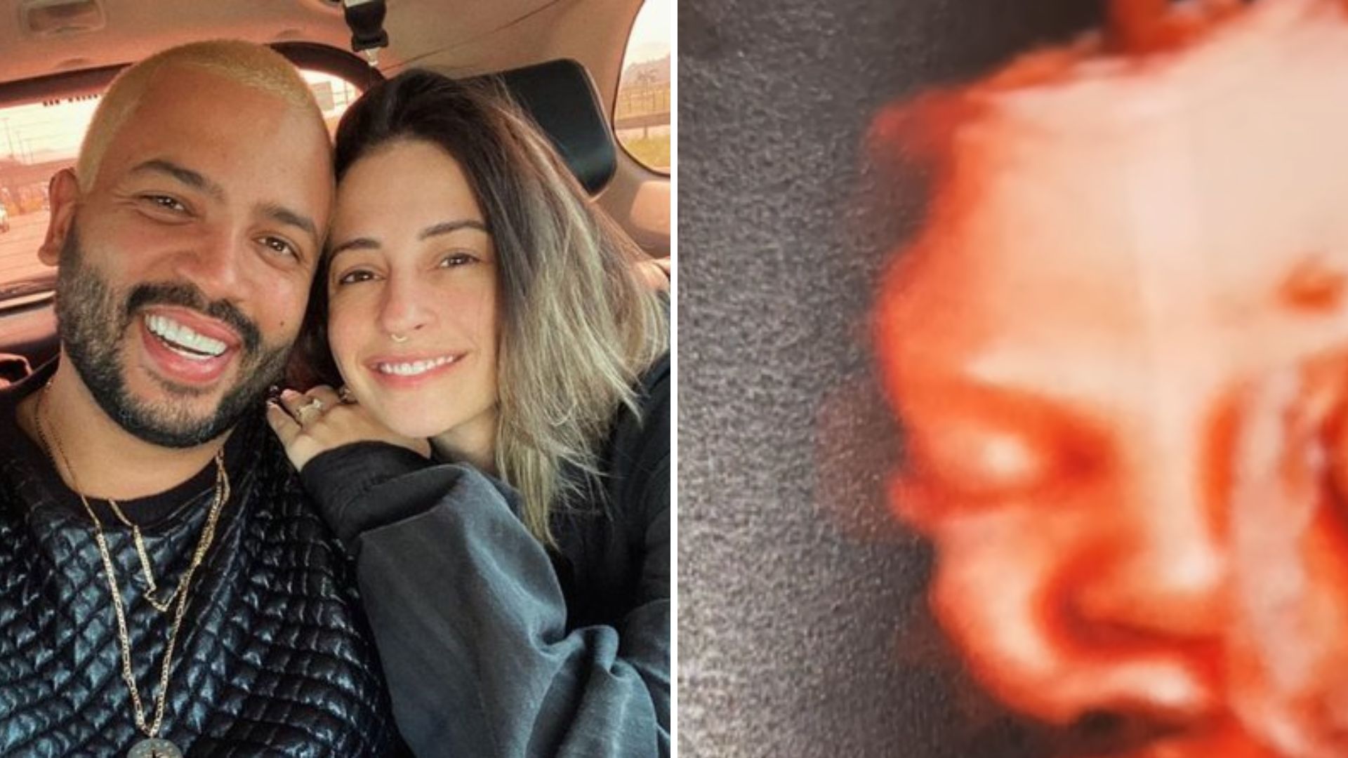 Separados, ex-esposa de Projota mostra rostinho do filho em ultrassom: “Mamãe que lute”