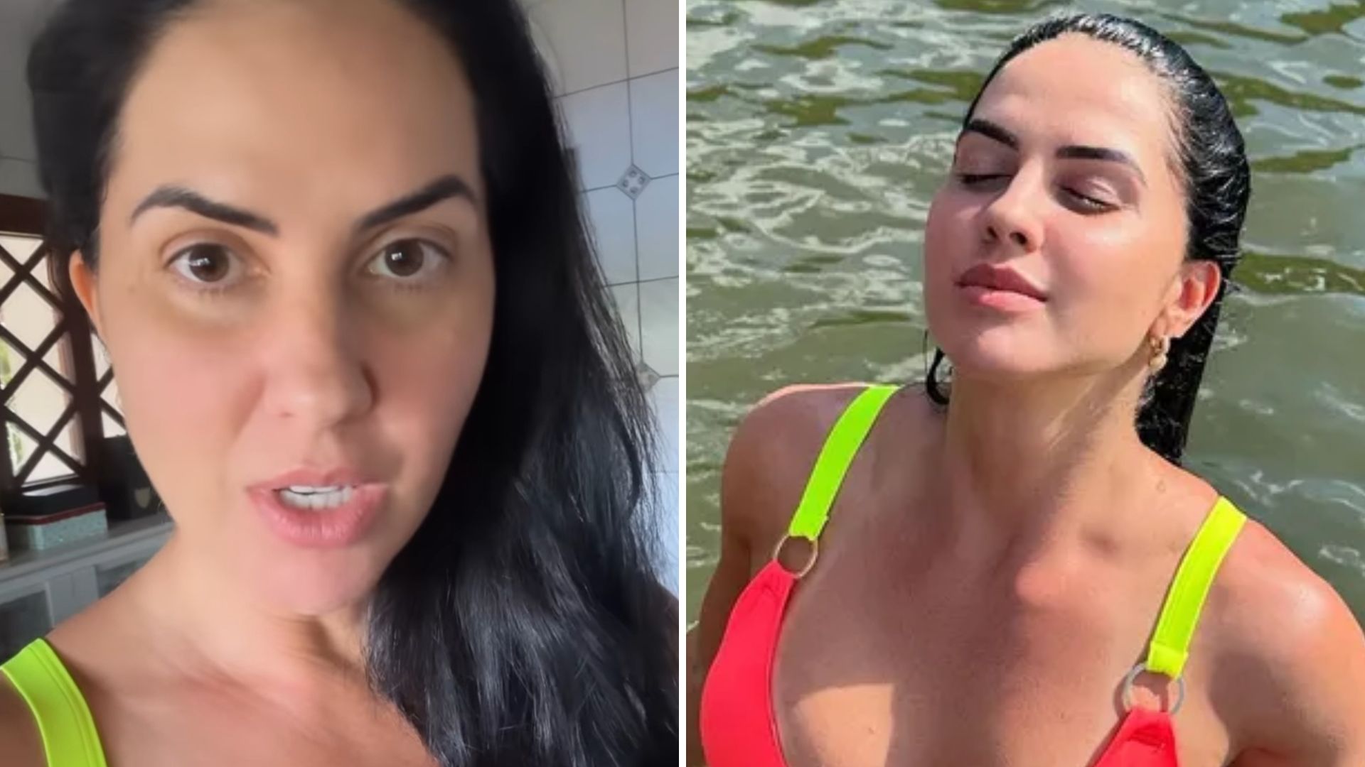 Graciele Lacerda revela trauma do passado e mostra superação: “Tive um acidente”