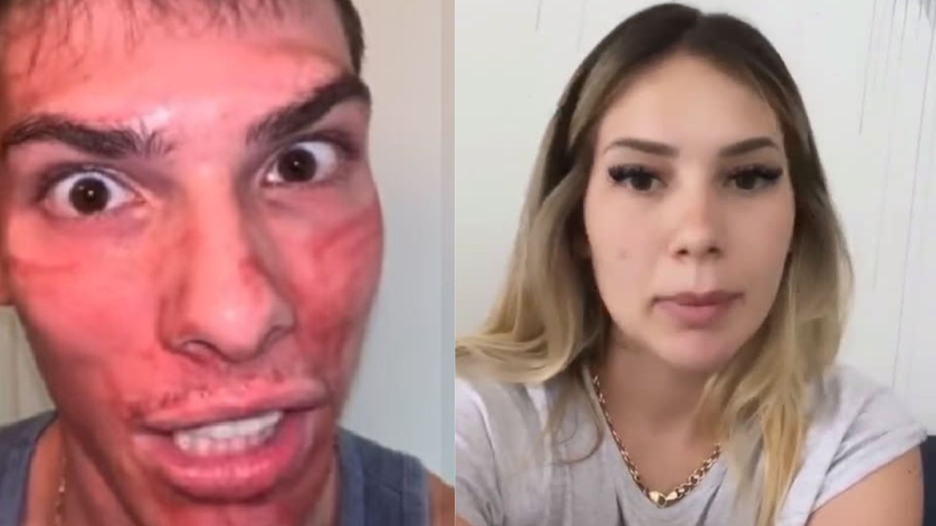 Influenciador surge com rosto deformado e ironiza base de Virgínia Fonseca: “Carne viva”