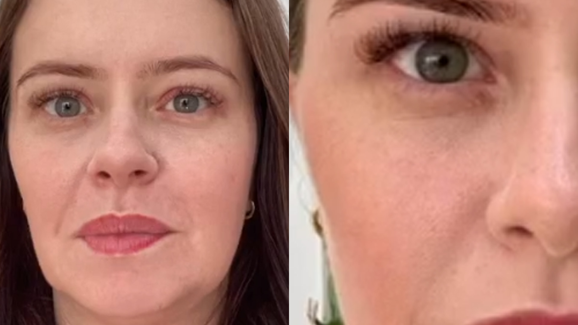 Mari Bridi passa por harmonização facial e mostra antes-e-depois: “Natural”