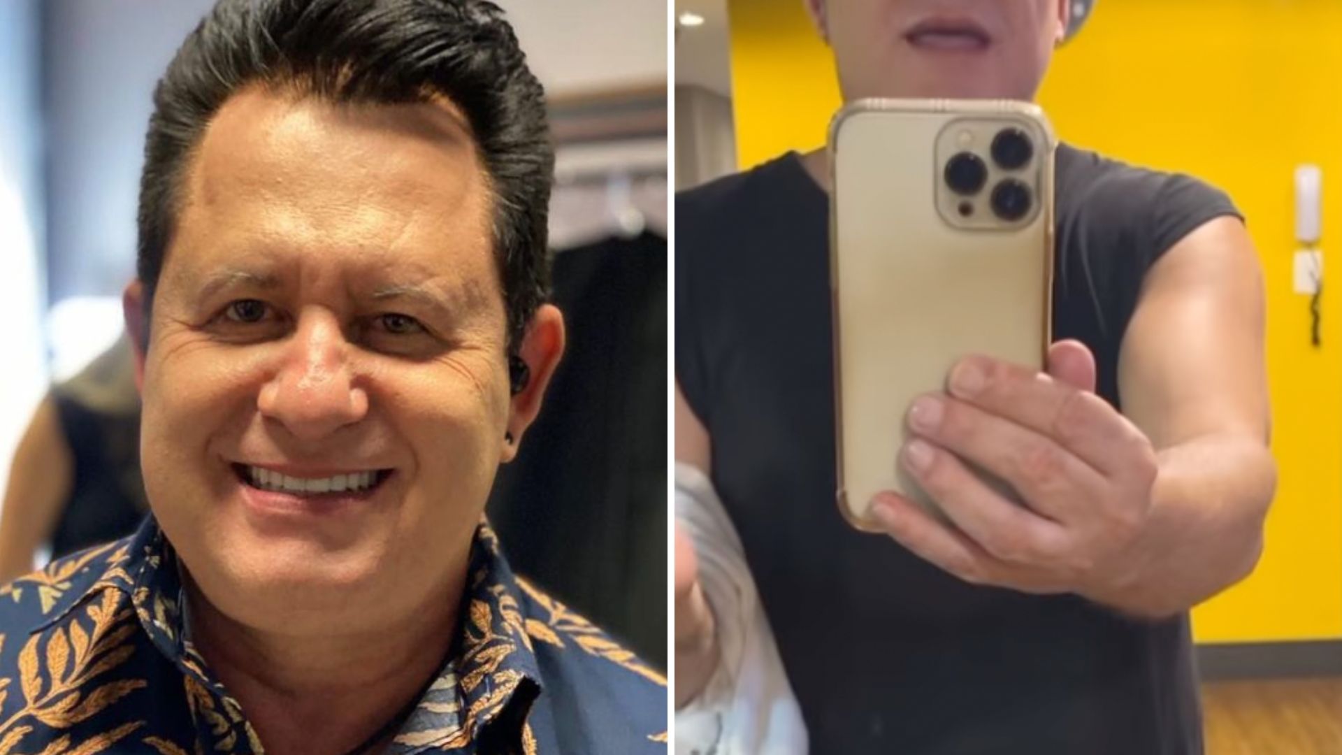 Marrrone mostra novo rosto após seis cirurgias plásticas: “Estou maravilhoso”
