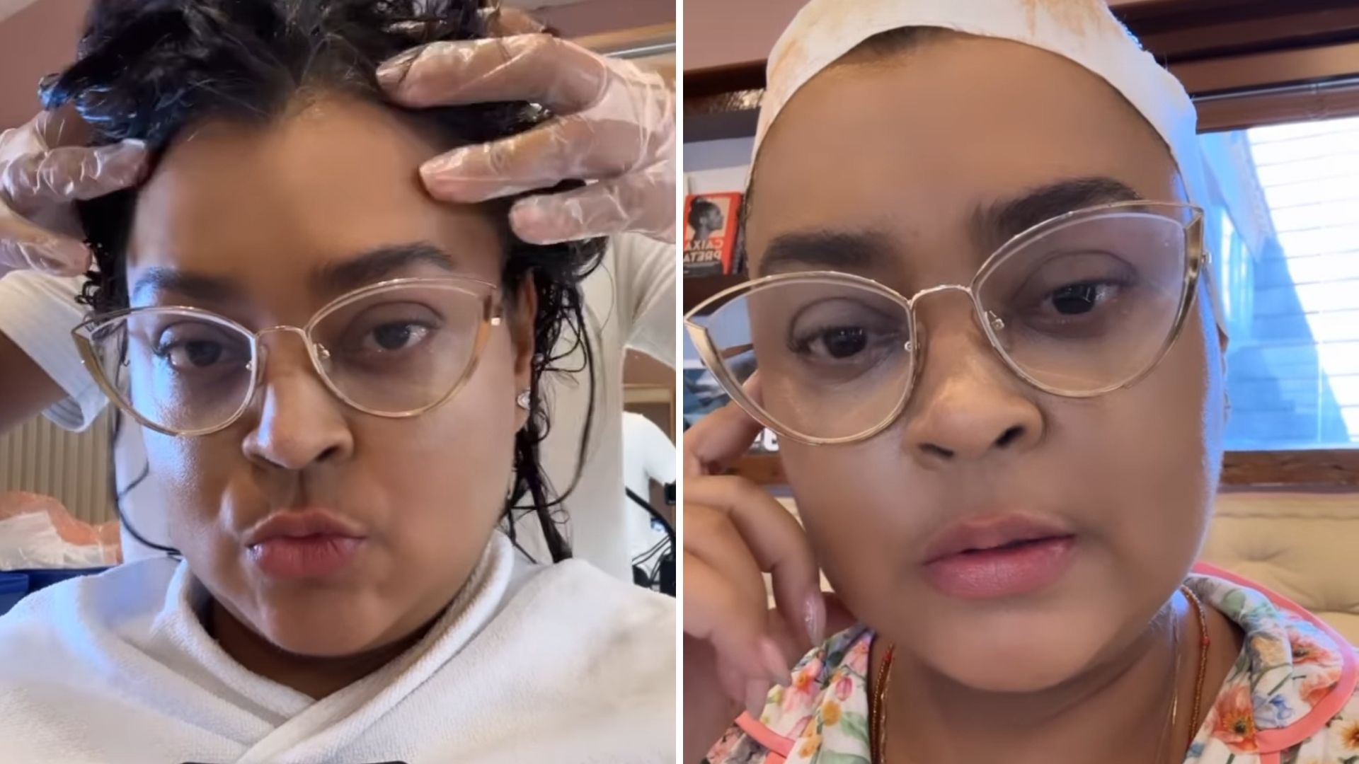 Preta Gil desabafa sobre cuidados com cabelo durante batalha contra câncer: “Diferente”