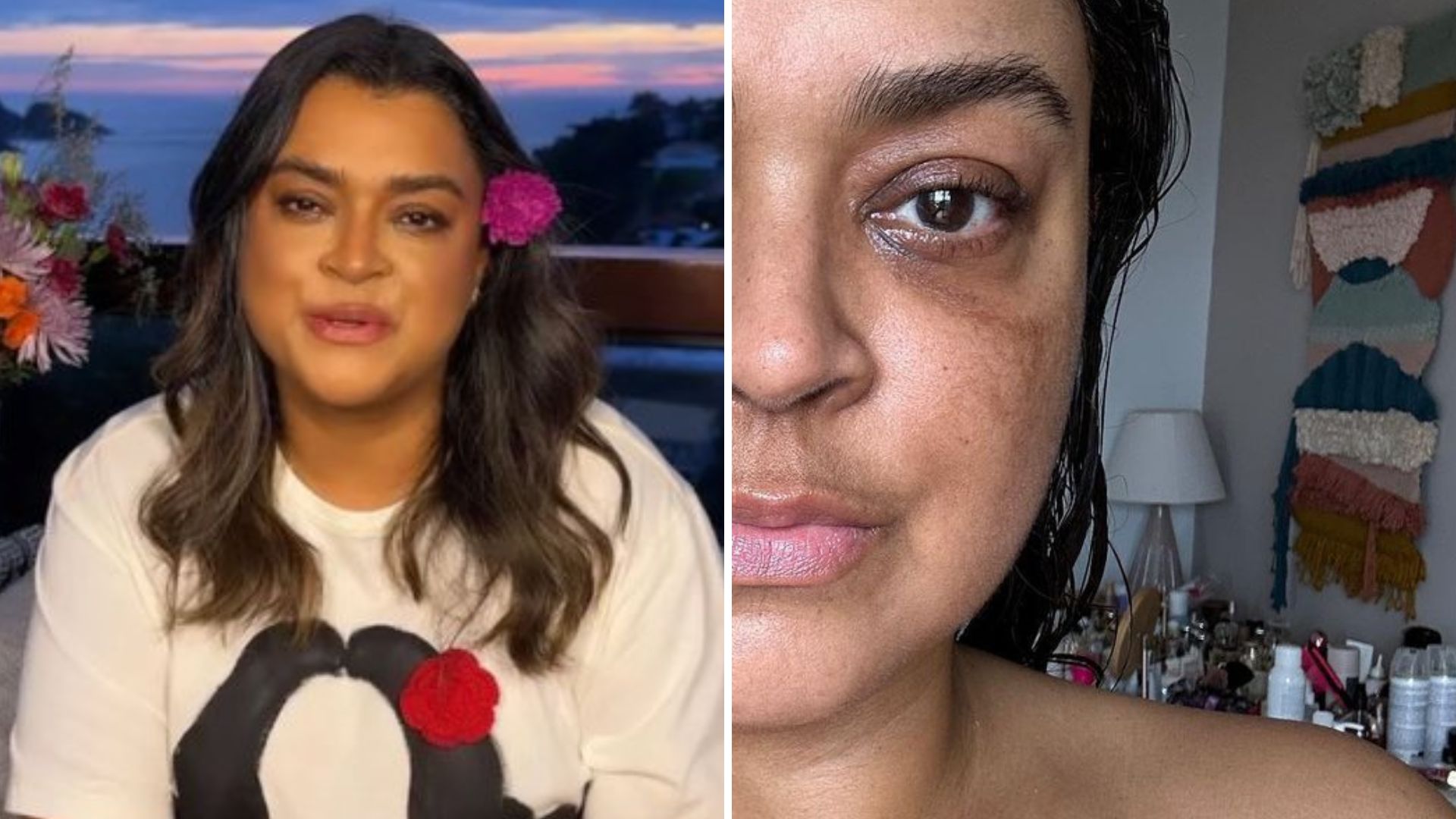 Lutando contra o câncer, Preta Gil exalta beleza natural sem maquiagem: “Liberdade”