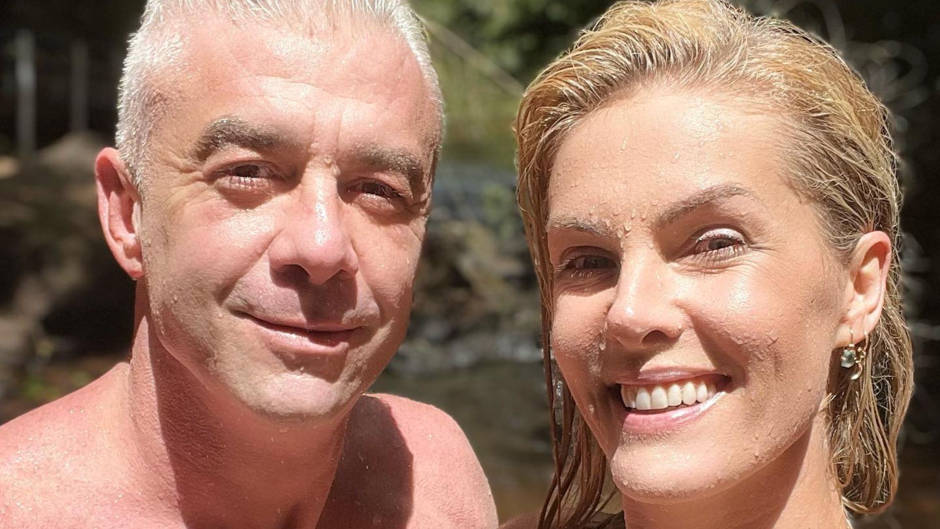 Ana Hickmann dá detalhes sobre agressão do marido, Alexandre Correa