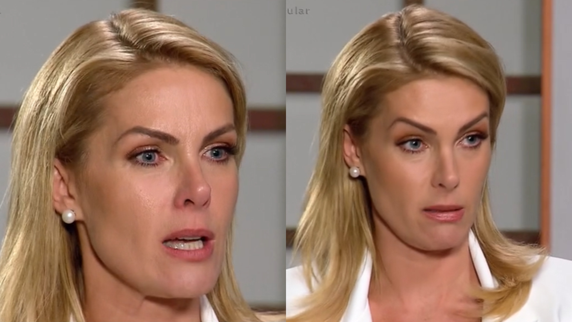Ana Hickmann faz forte desabafo após expor agressão: “Ninguém merece ser torturada”