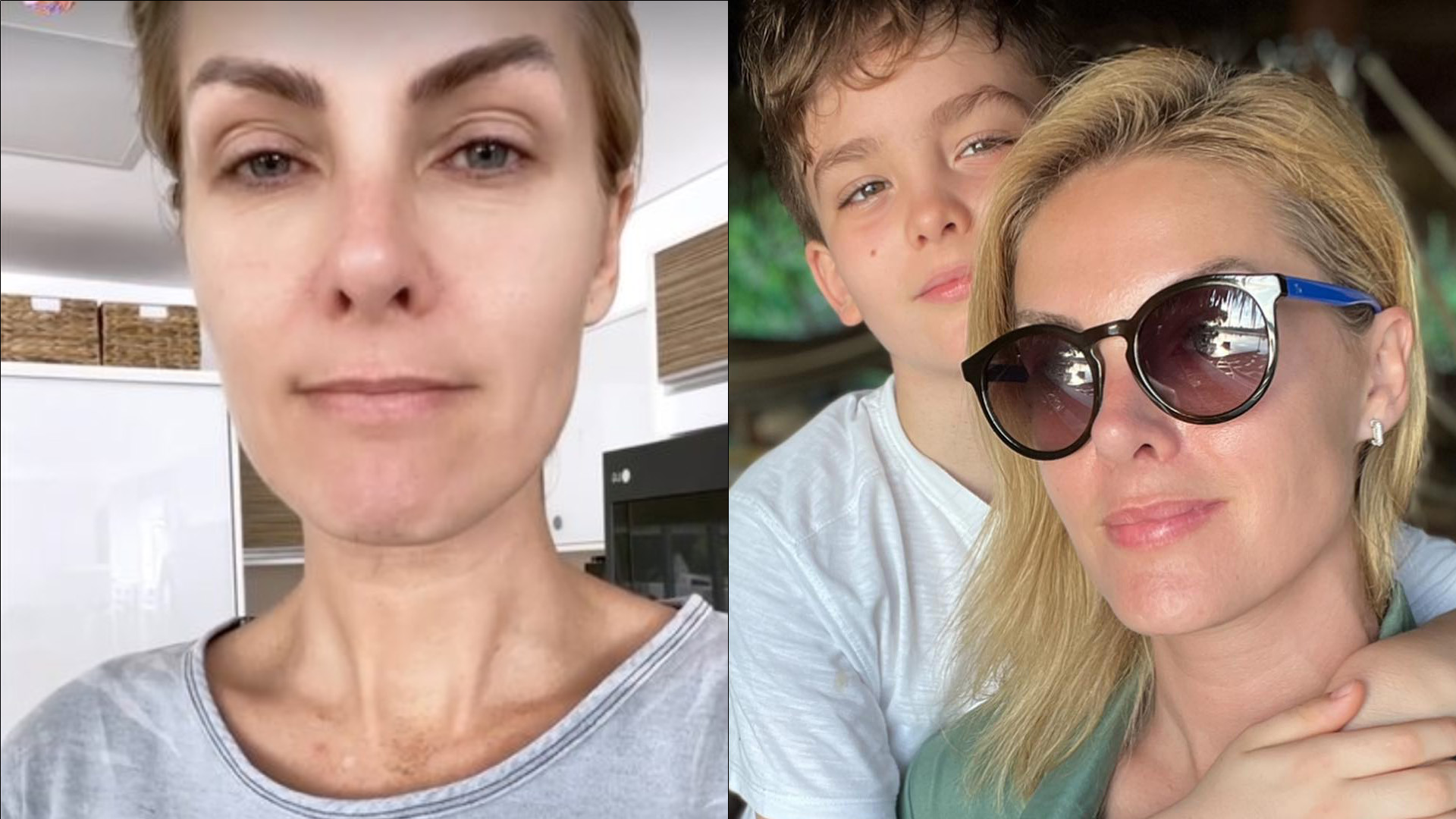 Após violência doméstica, Ana Hickmann expõe pedido emocionante do filho: “Ele pediu…”