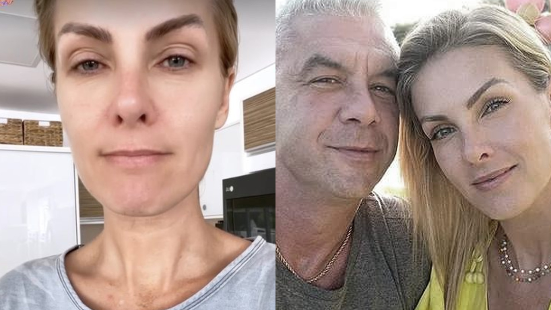 Ana Hickmann trata marido como ‘ex’ e detona em conversas íntimas: “Obcecado por dinheiro”