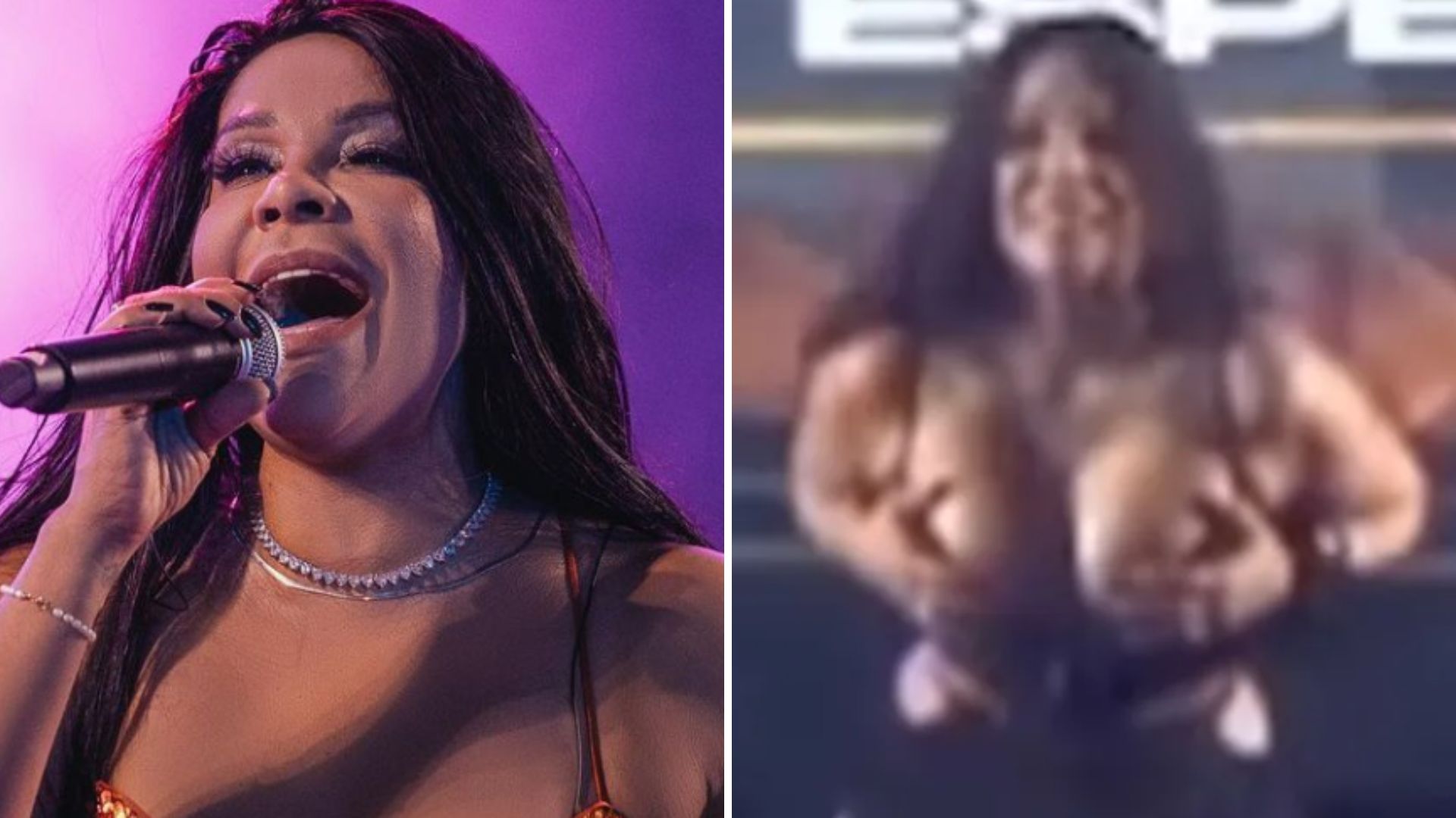 Cantora do Calcinha Preta se empolga e mostra os seios em show: “Médico autorizou”