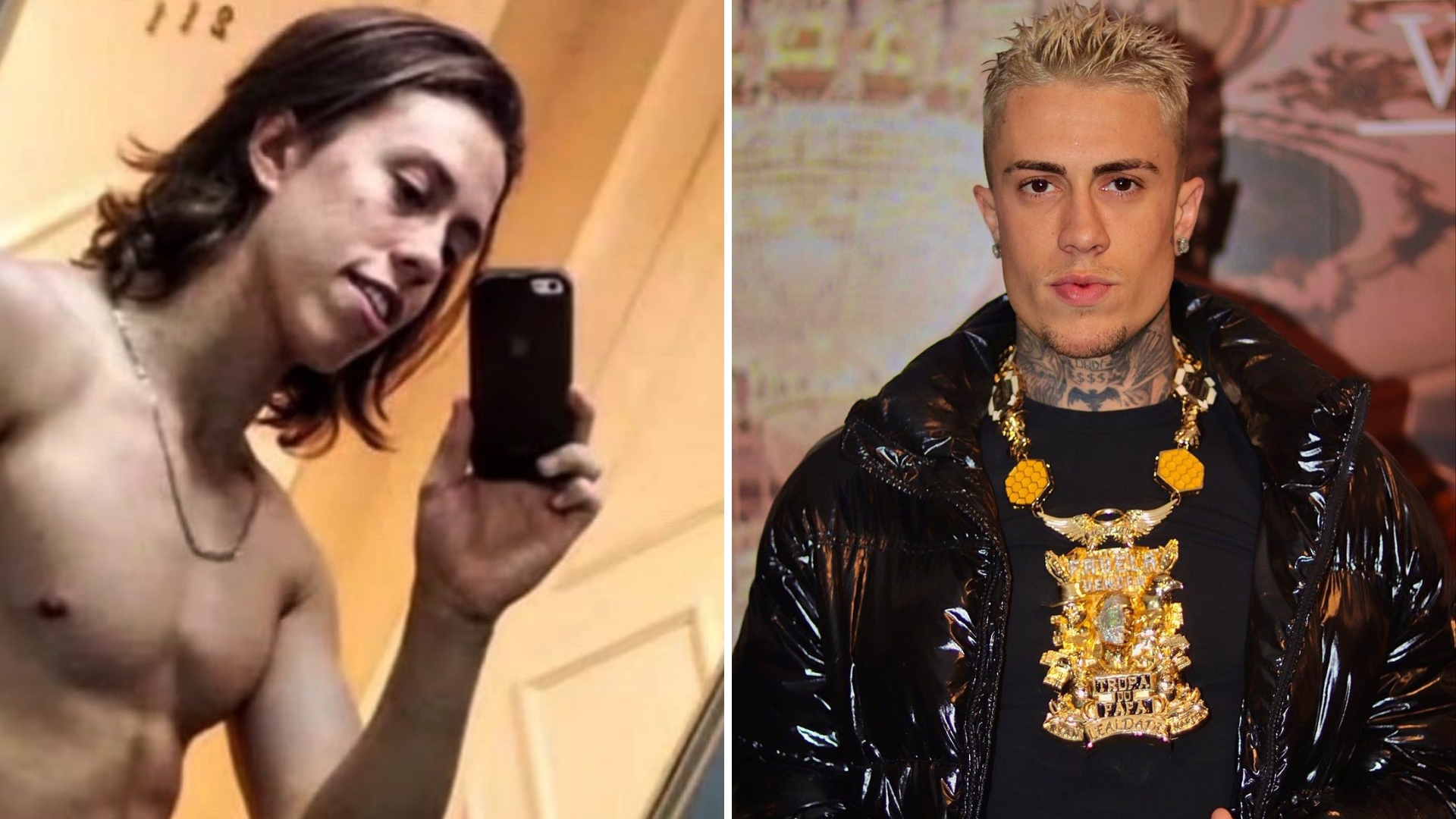 Ficou diferente? MC Daniel revela ter feito vários procedimentos estéticos: “Prefiro assumir”