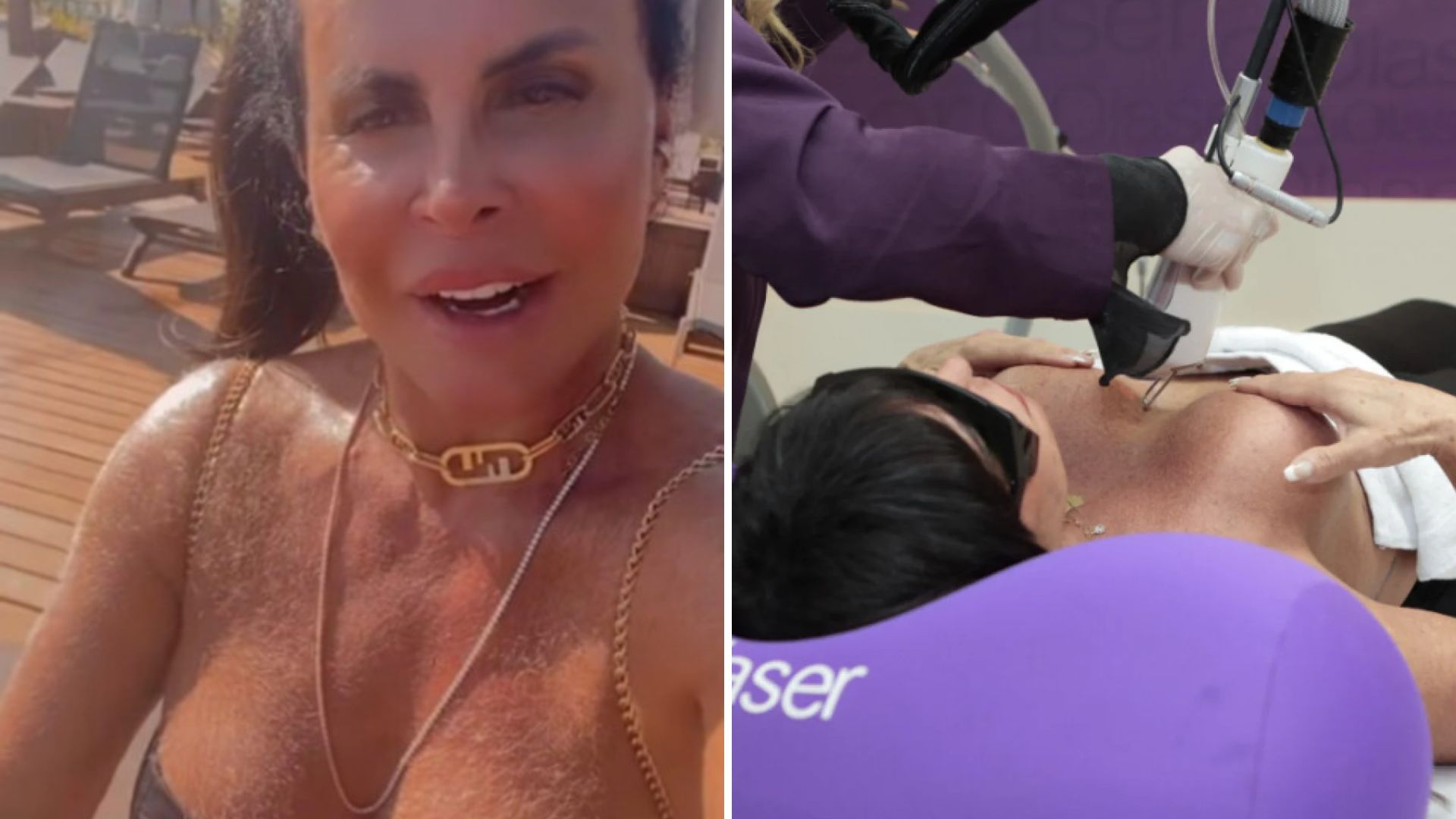 Gretchen se livra dos pelos nos seios: “No meu tempo e vontade”
