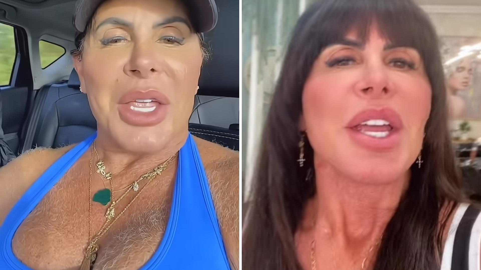 Gretchen rebate críticas por pelos na regiao dos seios: “Nem fico chocada”