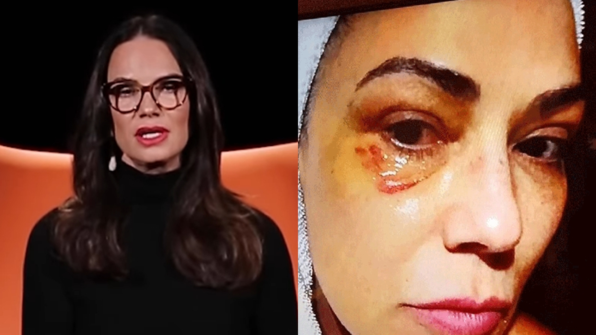 Luiza Brunet faz alerta sobre combate à violência contra a mulher: “Busque apoio”