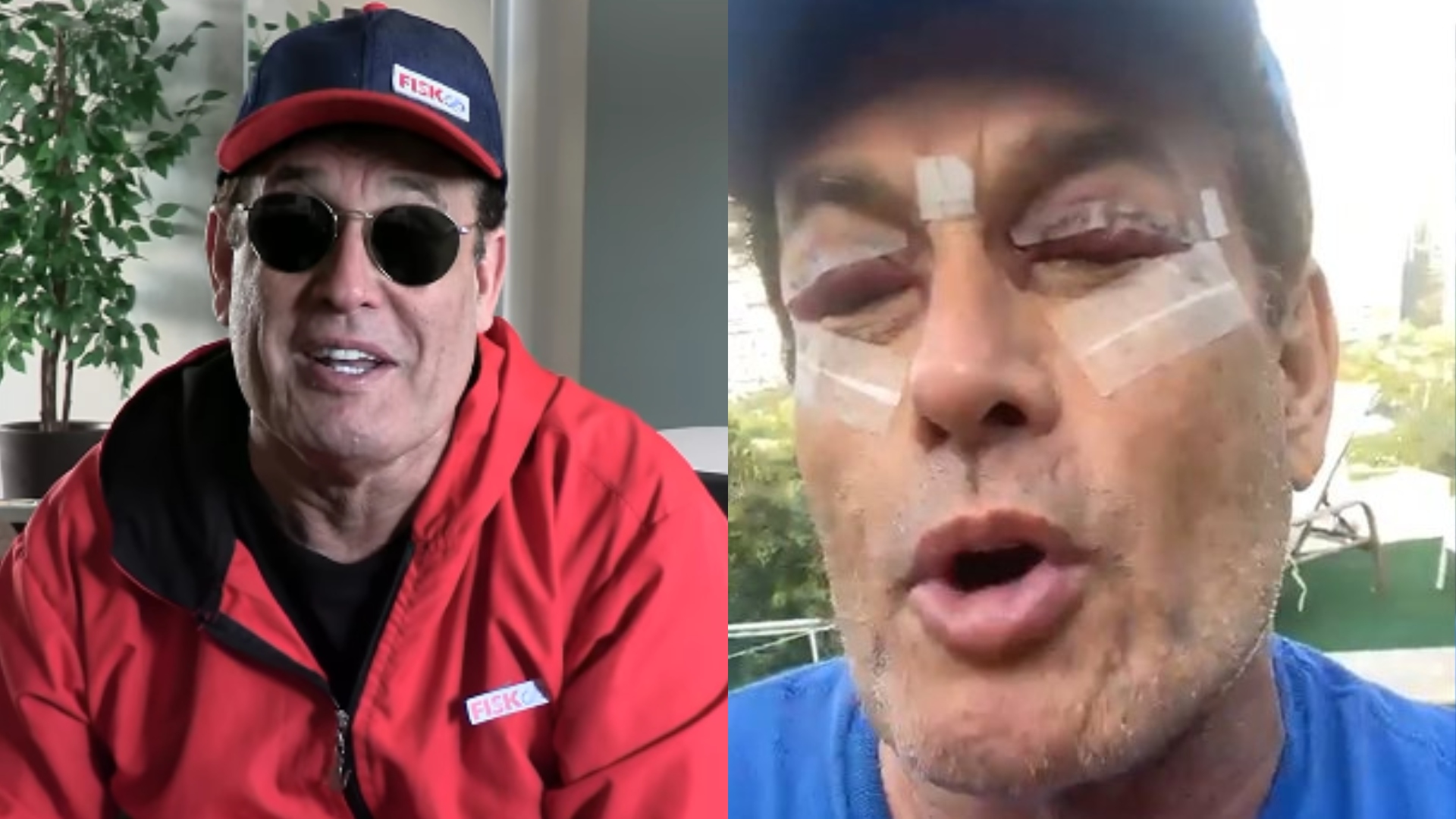 O que Sérgio Mallandro tem no olho? Humorista já precisou realizar cirurgia