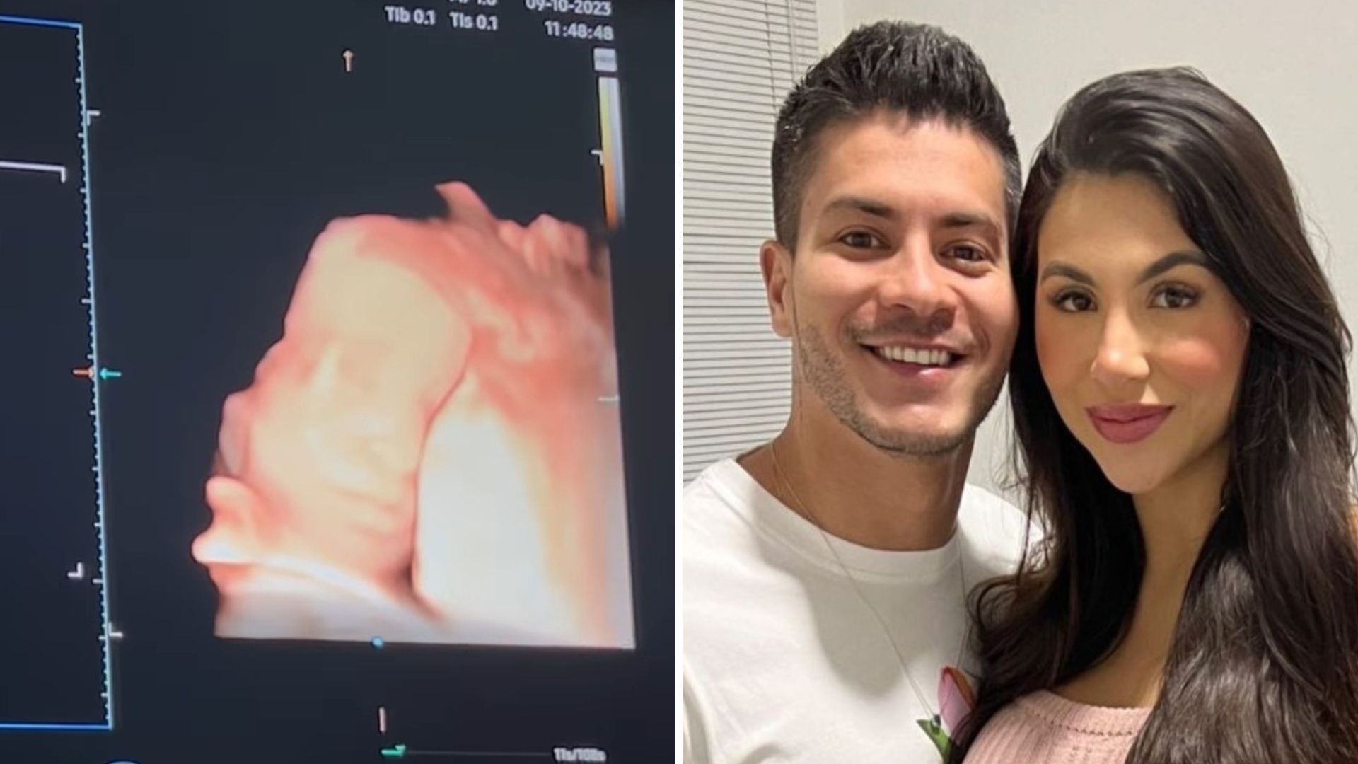 Arthur Aguiar e Jheny Santucci mostram ultrassom do primeiro filho: “Nosso bebê”