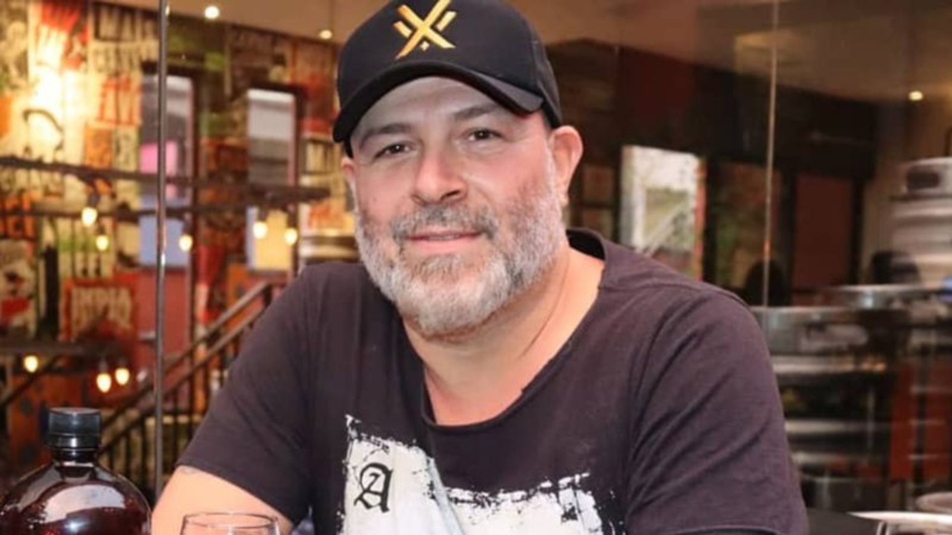 Como está Mingau? Baixista segue internado na UTI após tiro na cabeça