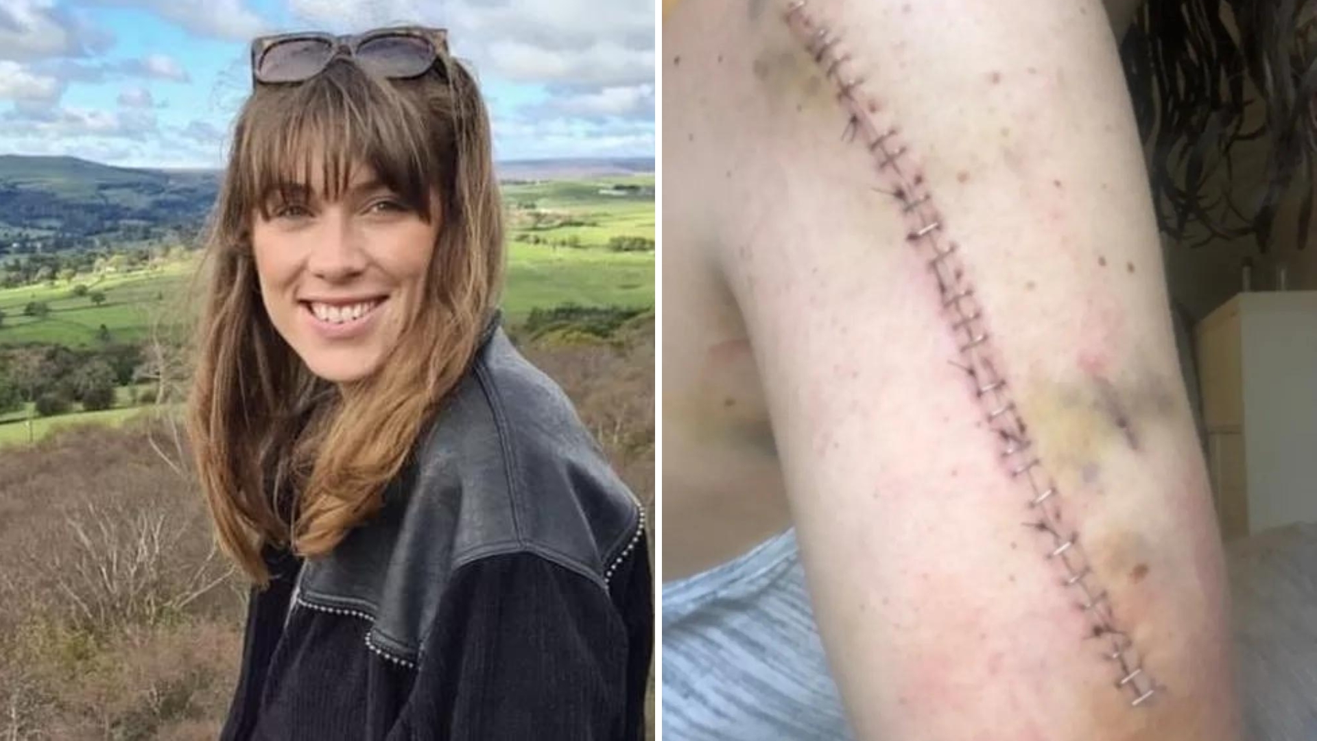 Jovem diagnosticada com câncer descobre, depois de dois anos, que nunca teve doença