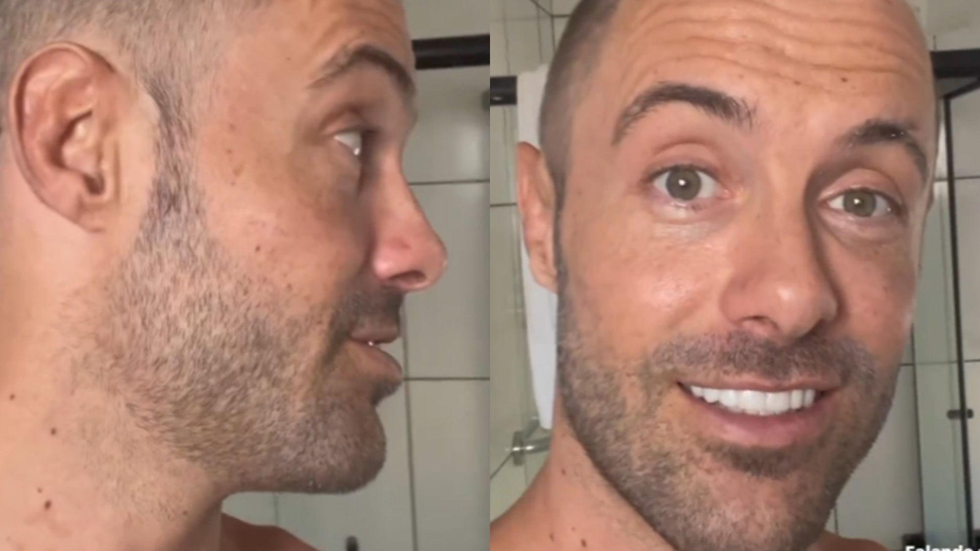 Kayky Brito reaparece em vídeo e deixa aparecer cicatriz na cabeça: “Só agradeço”