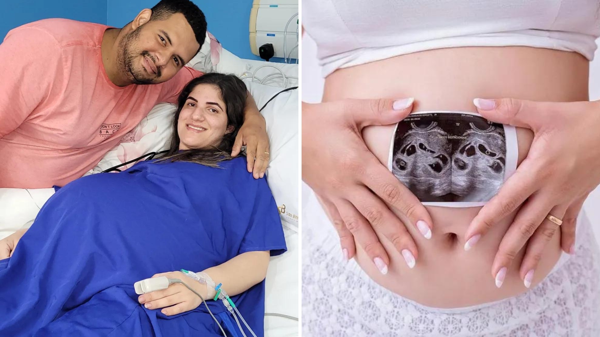 Quantos! Mulher da à luz sêxtuplos em parto de apenas 10 minutos