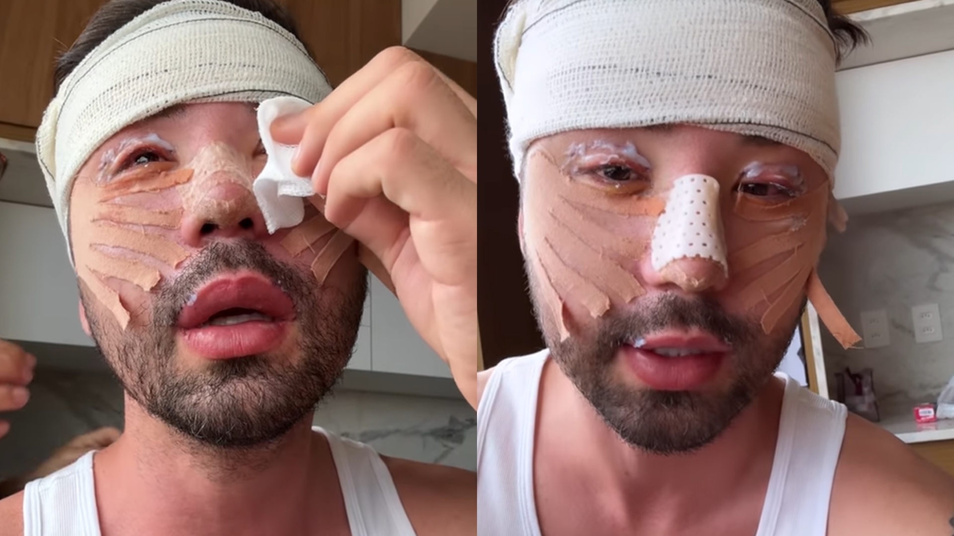 Rico Melquiades chora por duras críticas após cirurgias no rosto: “Vai acabar comigo”