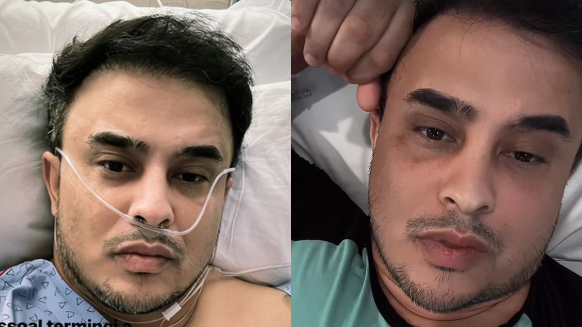 Kauan, dupla de Matheus, faz cirurgia às pressas após fortes dores: “Foi complicado”