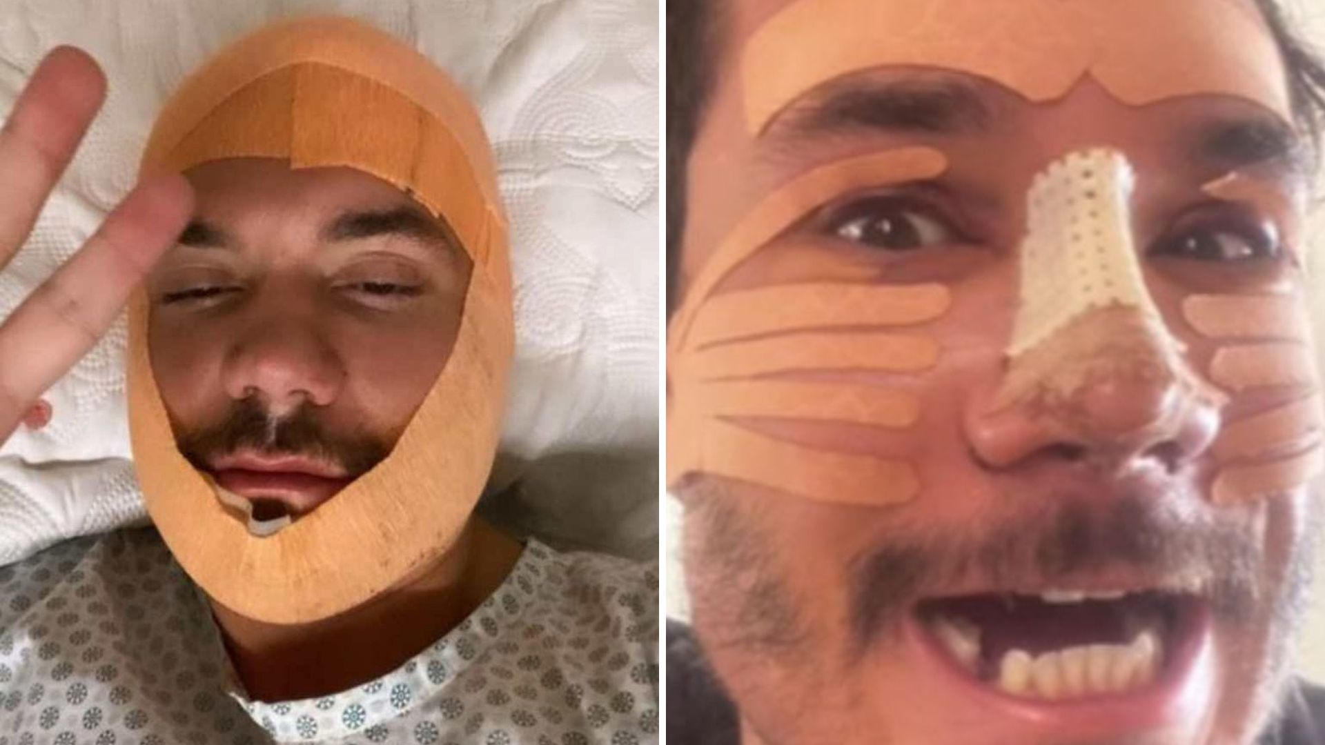 Redução de mamas, rinoplastia e mais: Descubra quantos procedimentos Eliezer já fez