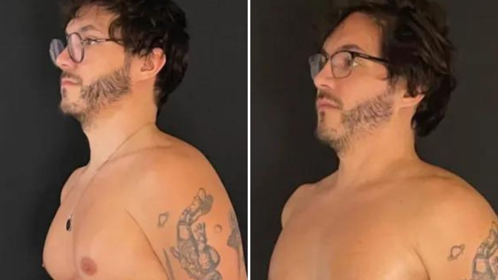 20 dias depois, ex-BBB Eliezer mostra resultado da cirurgia de redução de mamas: “Chocante”