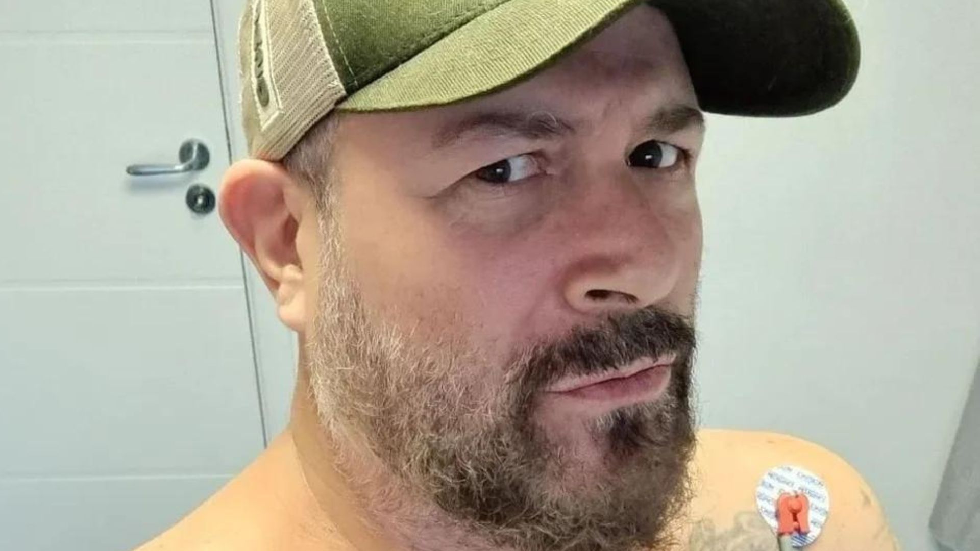 Lutando pela vida! Mingau, do Ultraje a Rigor, passa por novo procedimento cirúrgico