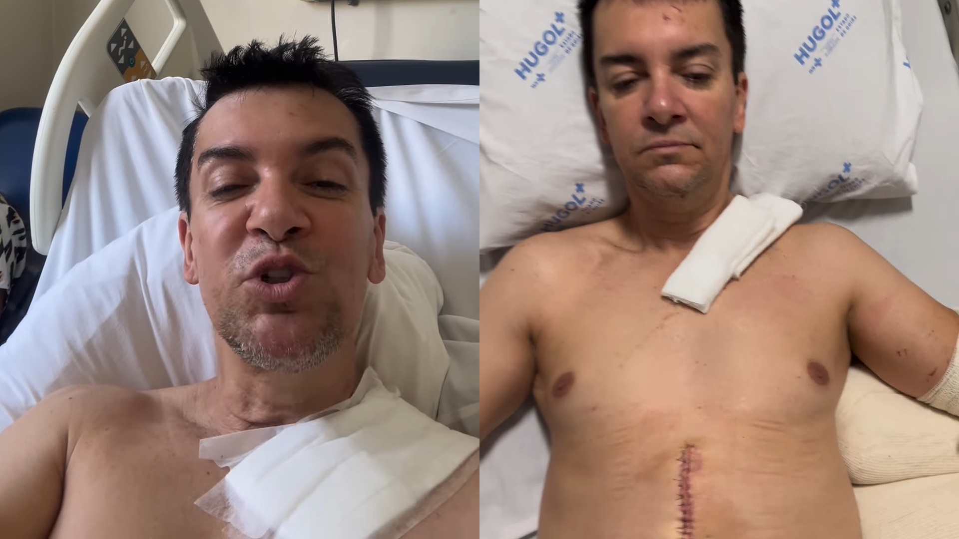 Regis Danese atualiza estado de saúde após grave acidente: “Médicos estão surpresos”